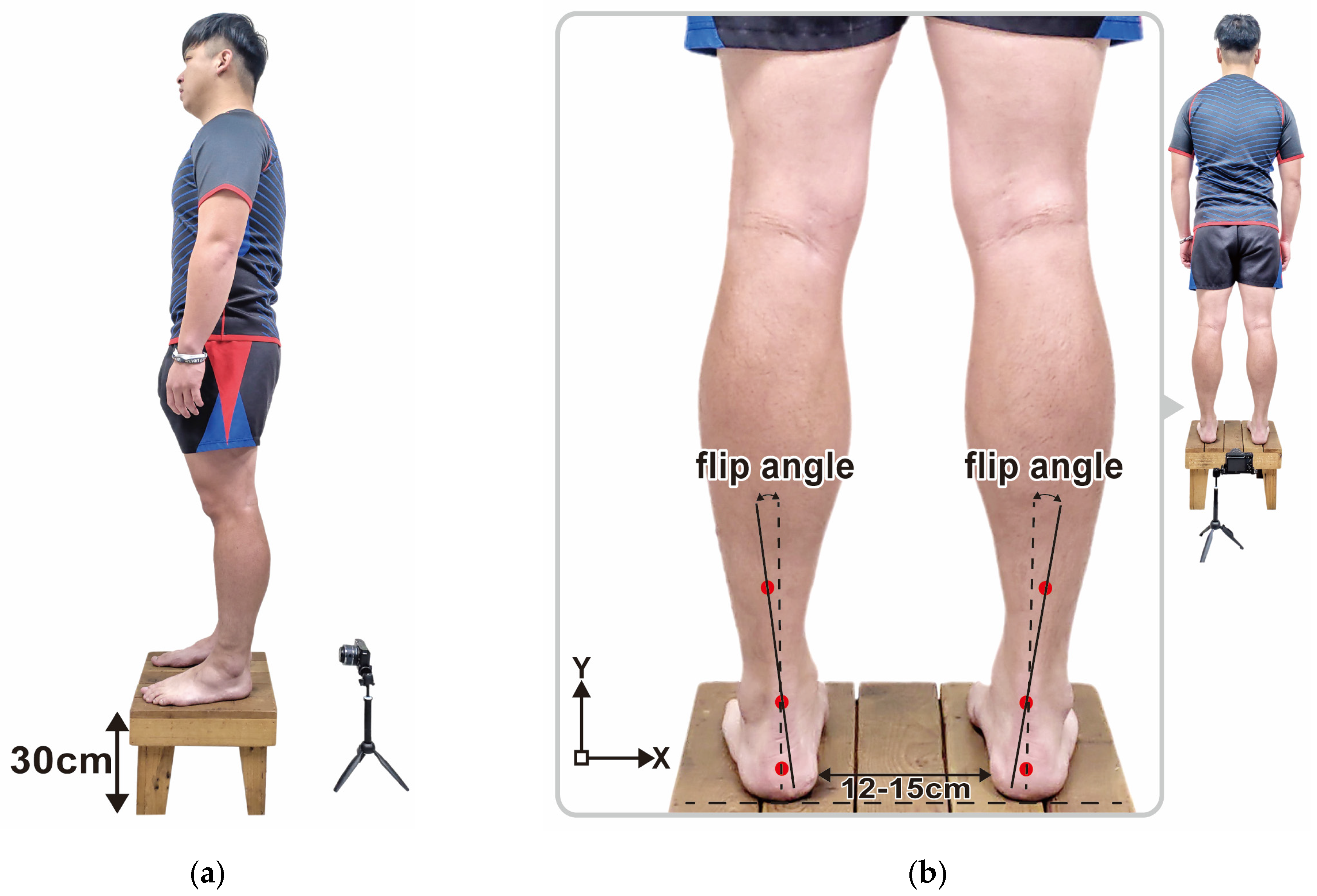 Muscles of the Leg (Calf) and Foot (Lateral View) (Advanced)