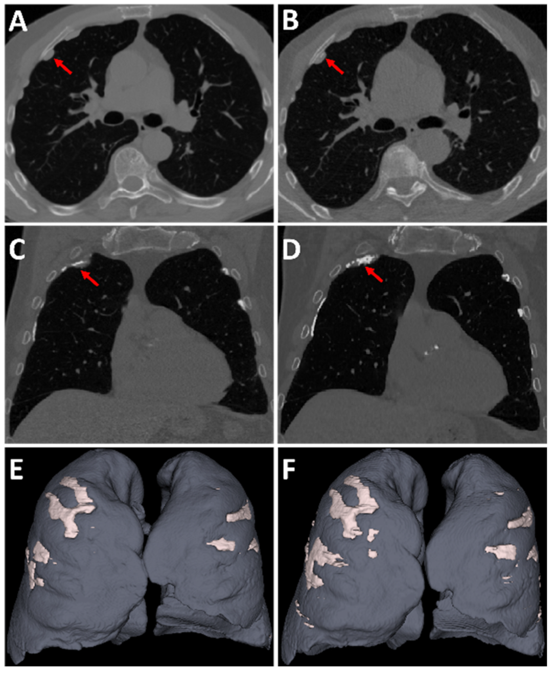 Ijerph 19 01417 g003