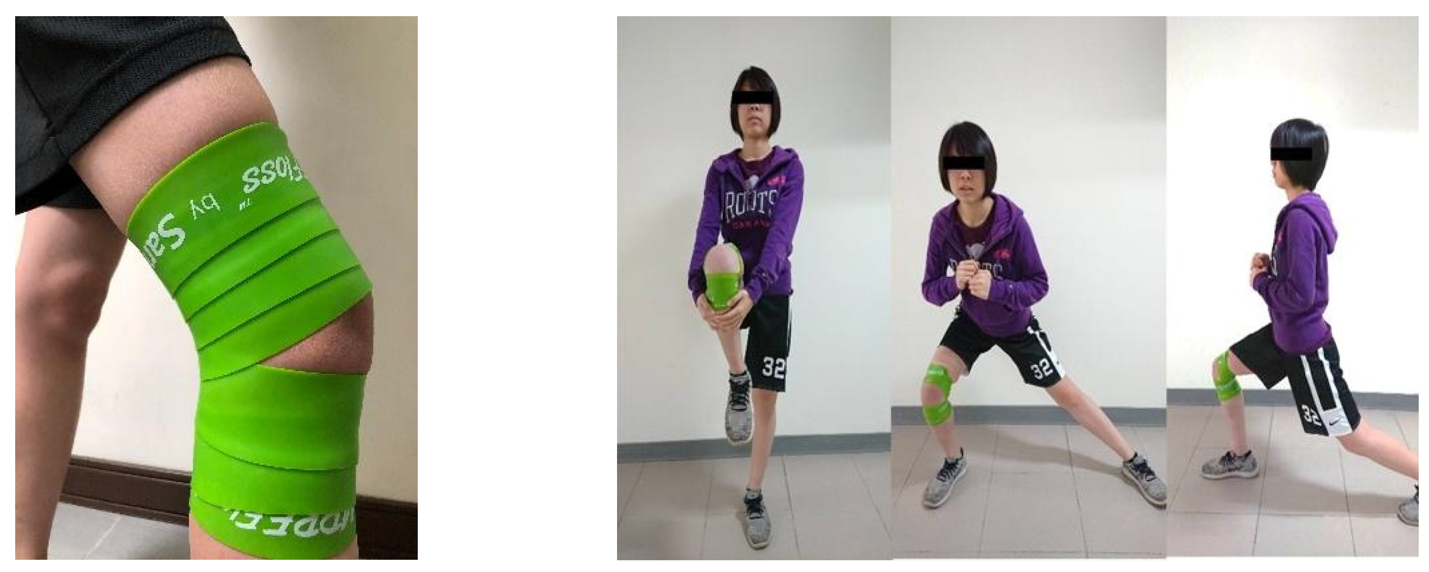 IJERPH | Free | Acute Effects of Tissue Flossing with Functional Movements on Knee Range of Motion, Static Balance, in Single-Leg Hop Distance, and Landing Stabilization Performance Female College