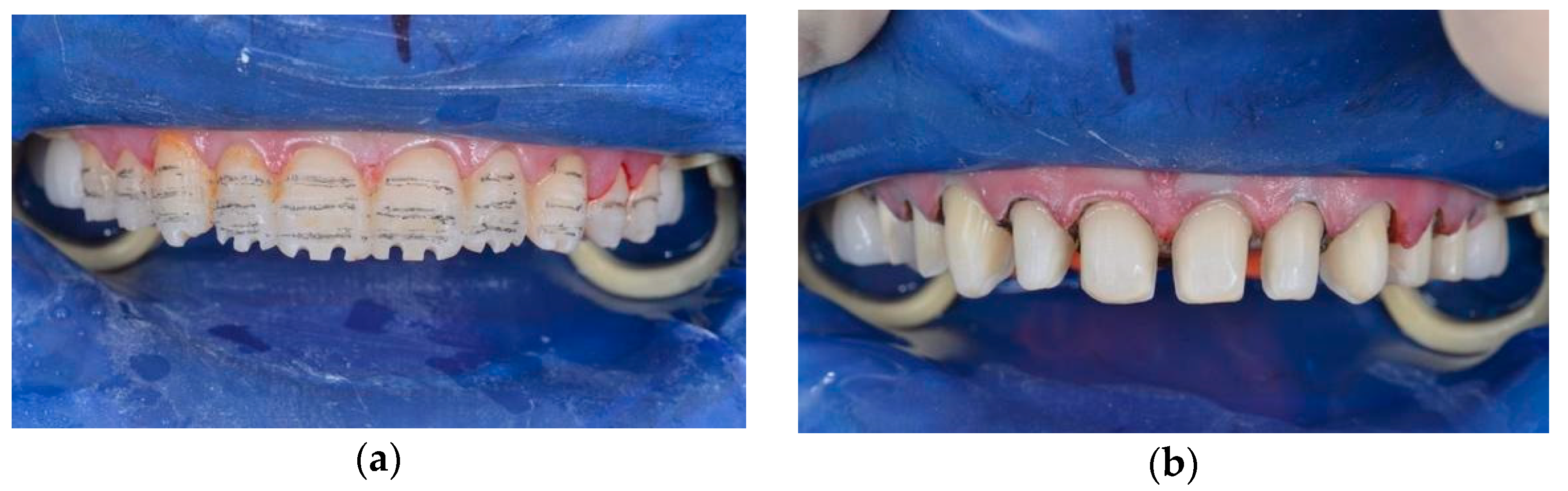 Ijerph 19 01474 g011 550