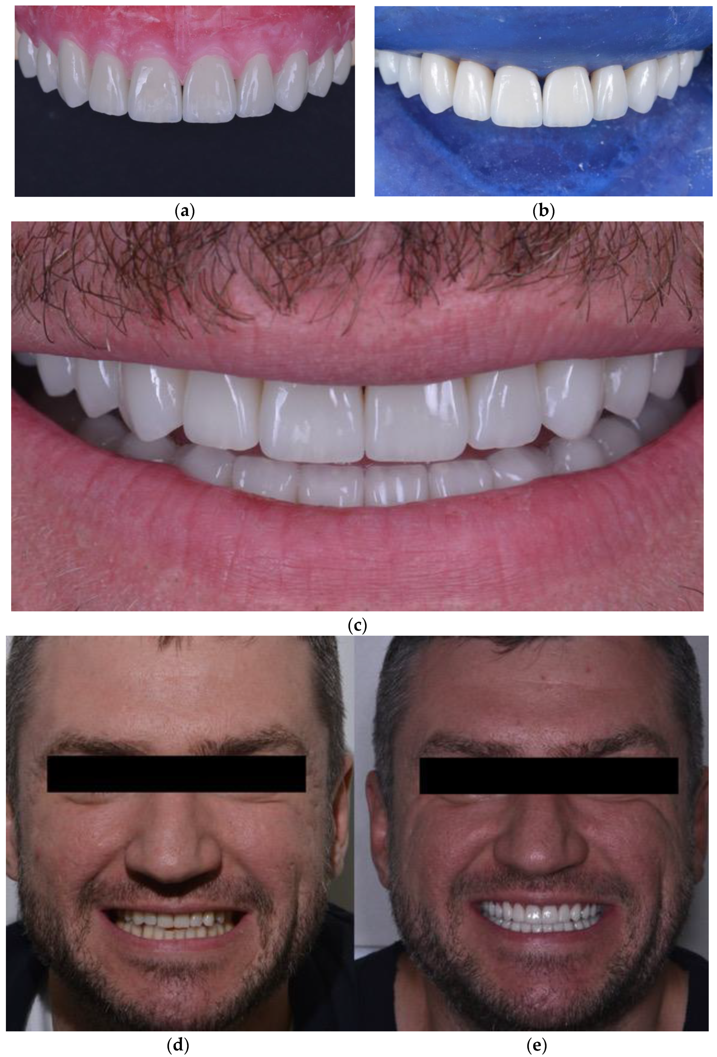 Ijerph 19 01474 g012 550