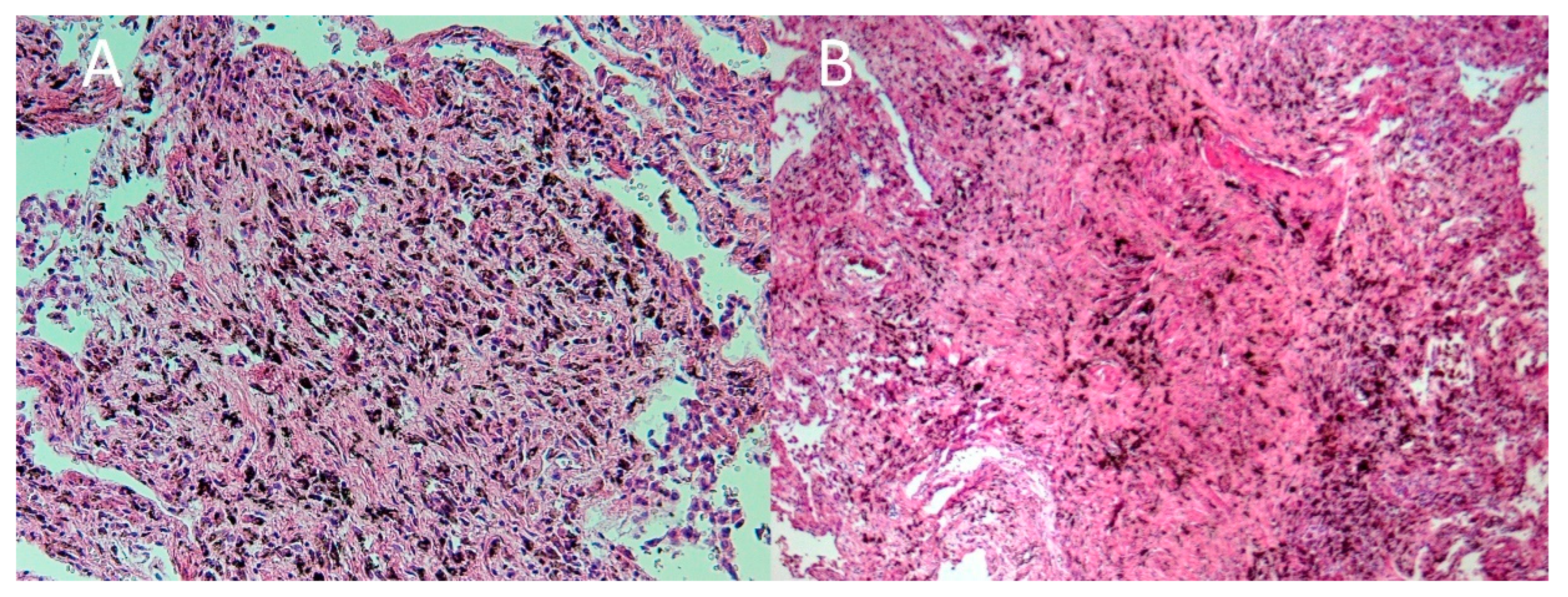 Ijerph 19 02297 g005 Ijerph 19 02297 g005