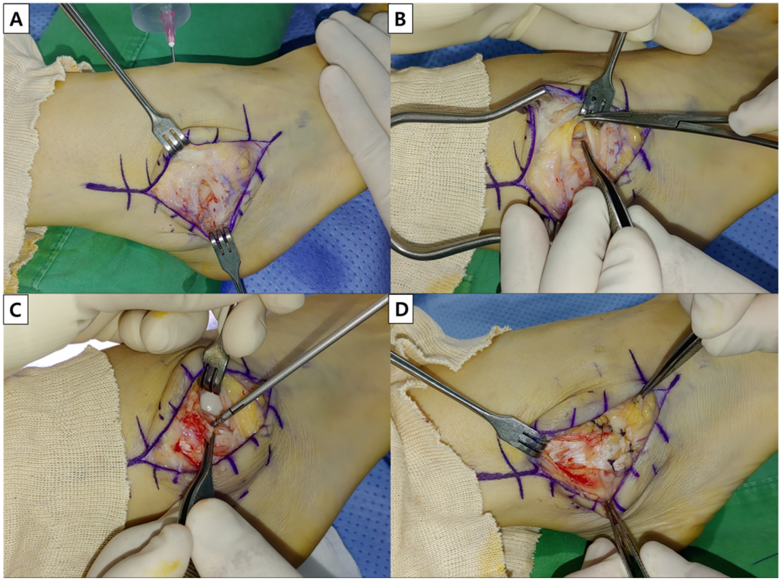 Ijerph 19 02428 g002