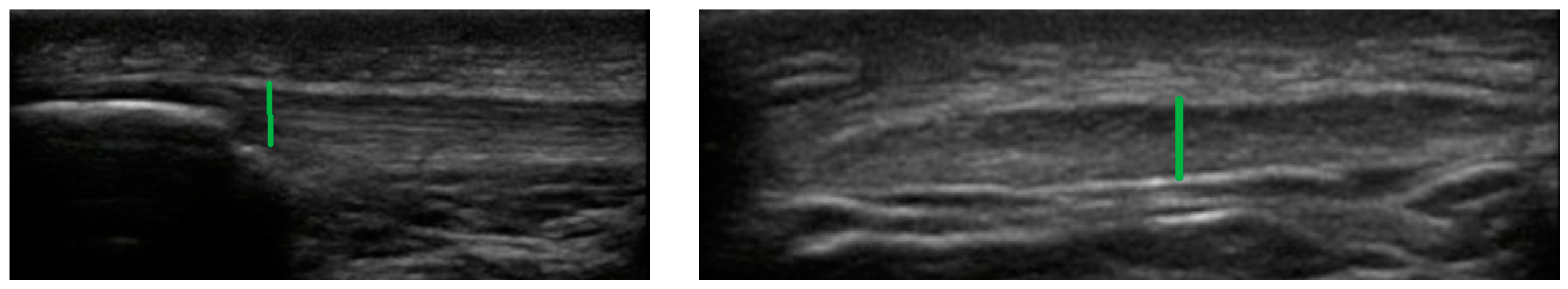 Ijerph 19 02468 g002