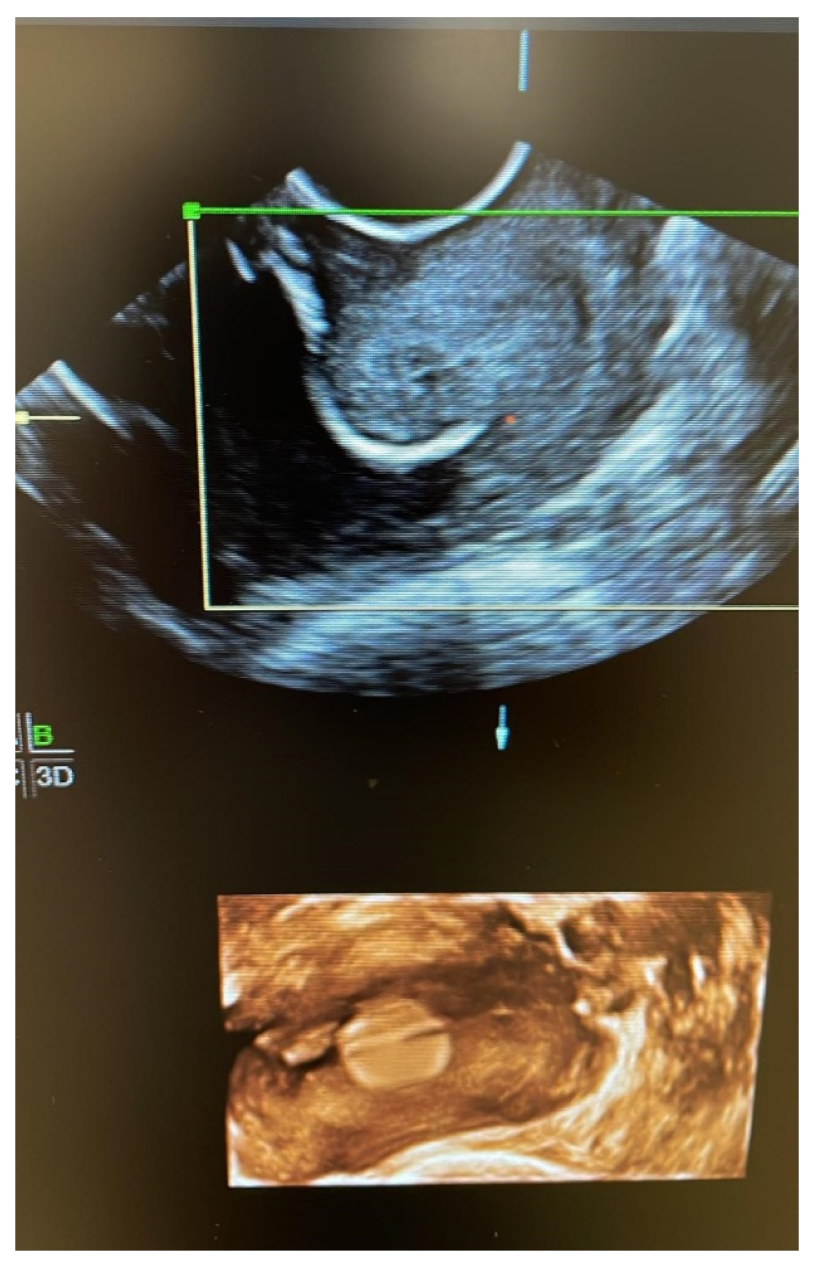 Ijerph 19 02636 g006 550