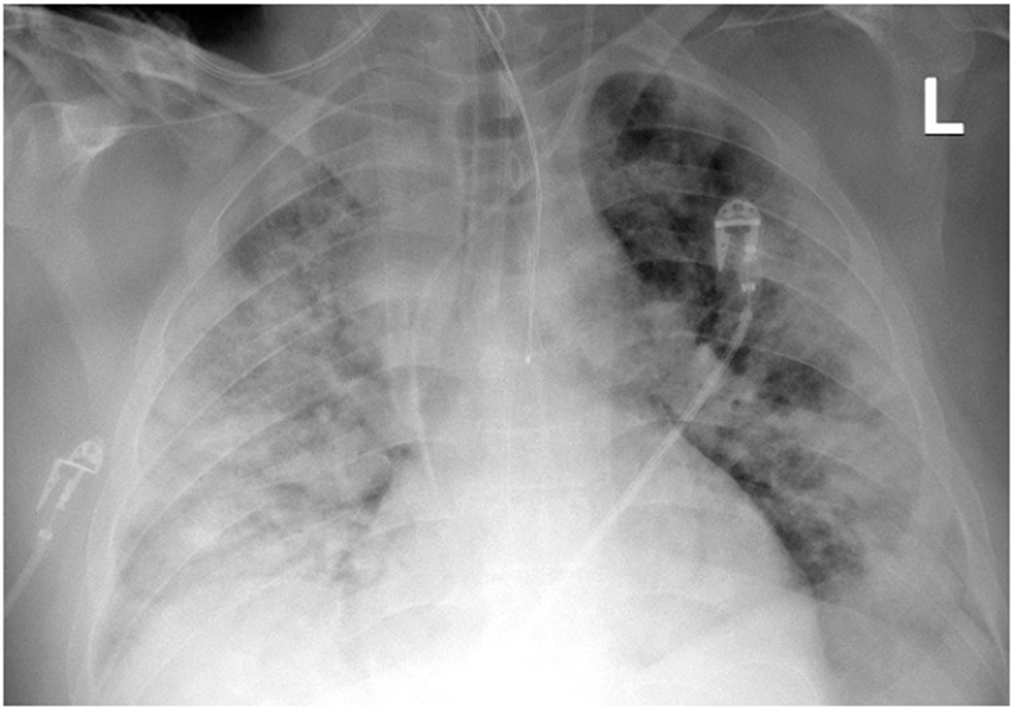 Ijerph 19 02761 g002 550