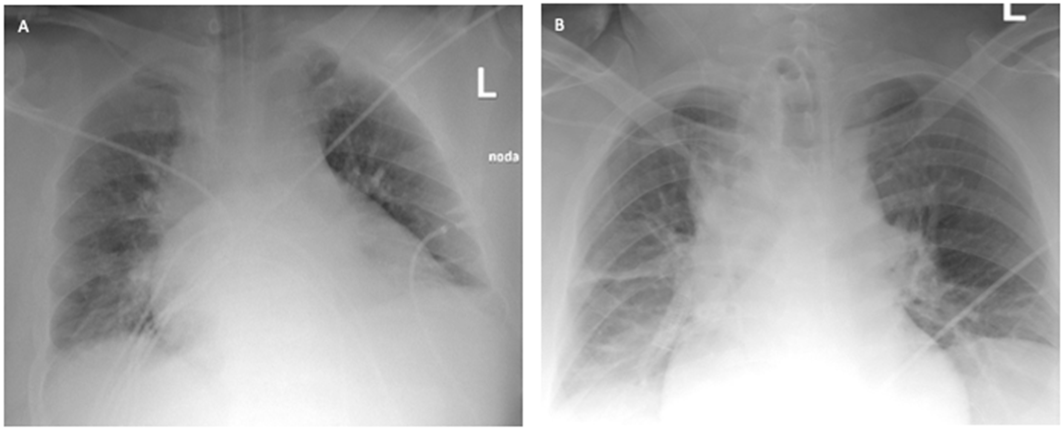 Ijerph 19 02761 g004 550