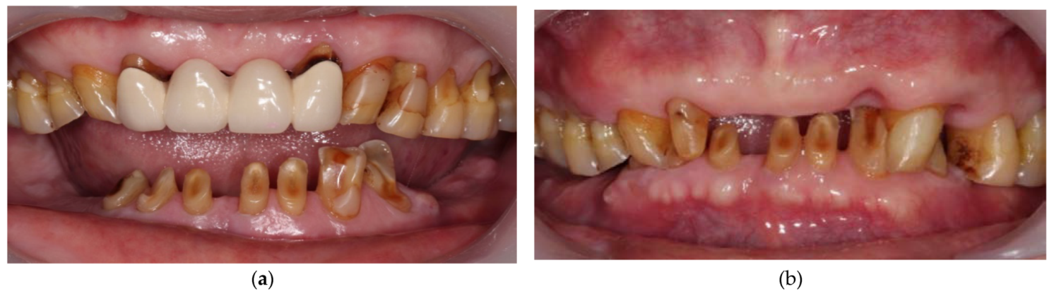 Ijerph 19 03021 g003 550