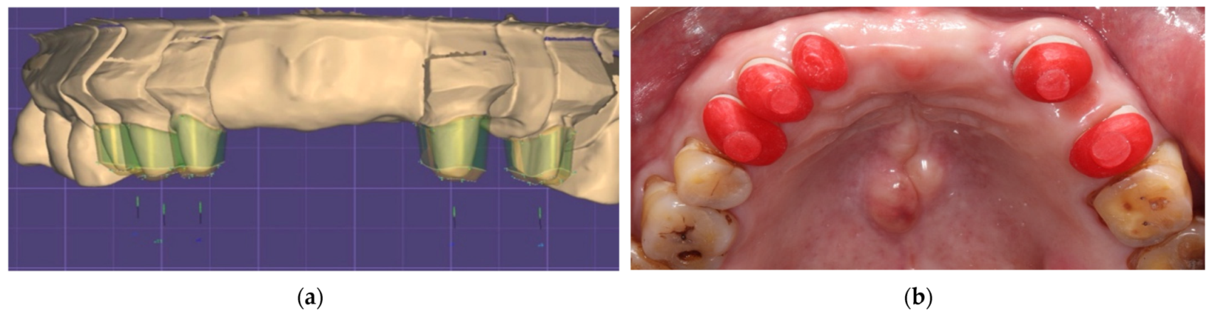 Ijerph 19 03021 g004 550