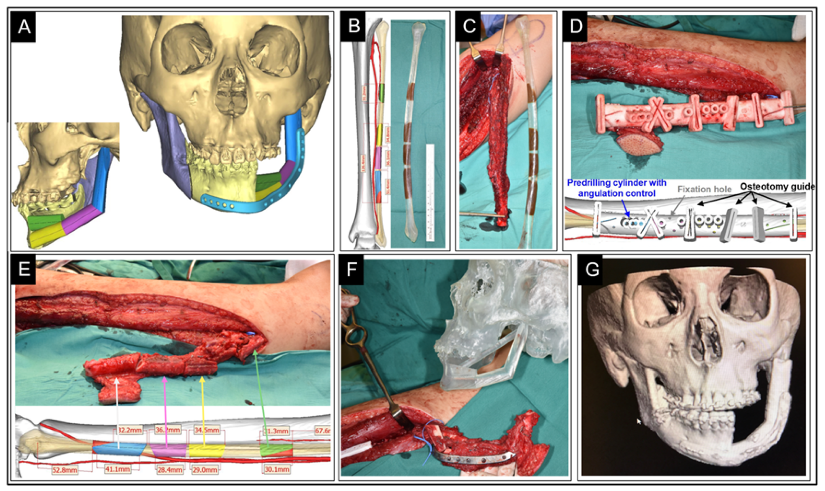 Ijerph 19 03331 g008 Ijerph 19 03331 g008