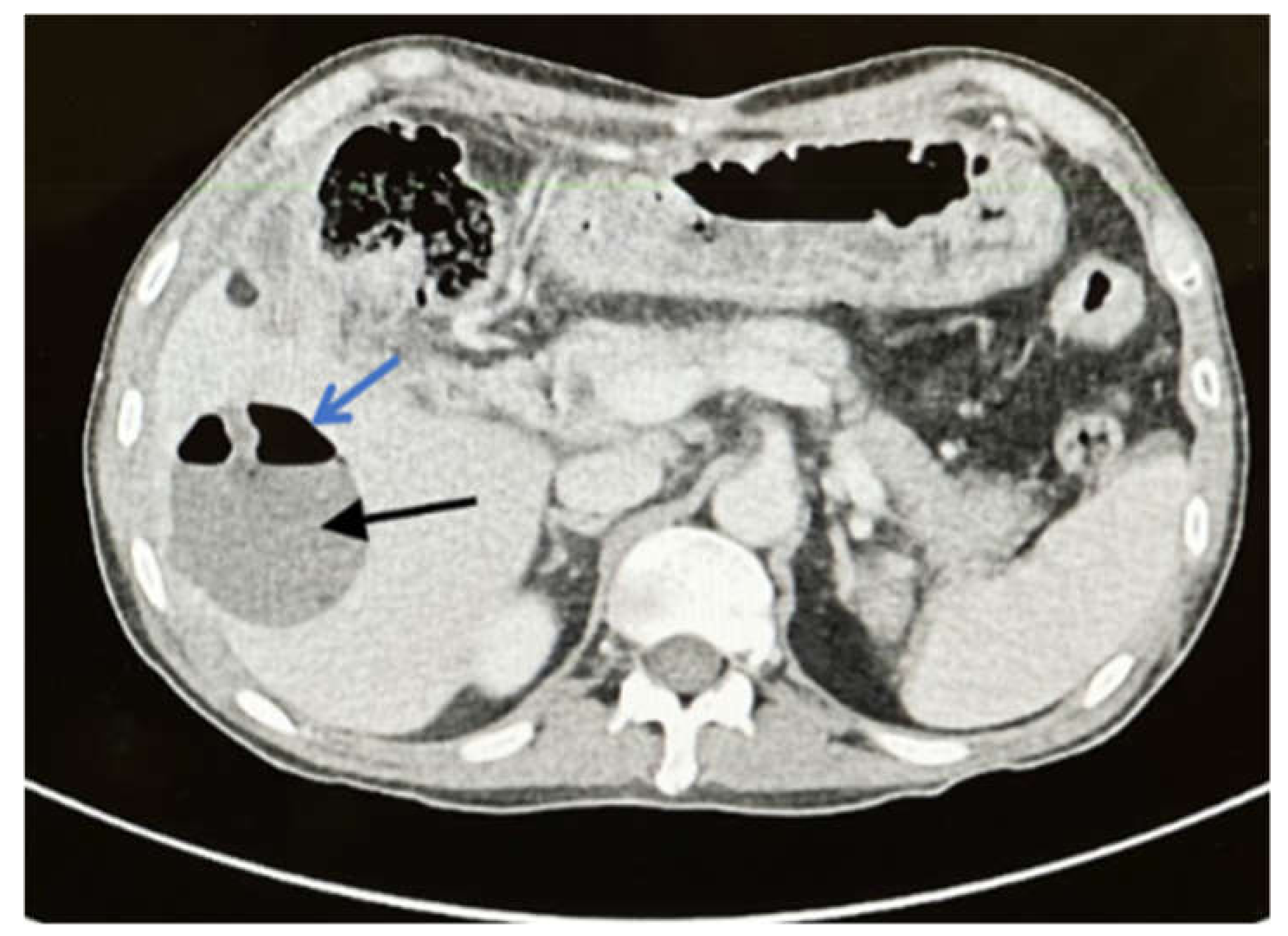 Ijerph 19 03412 g004 550