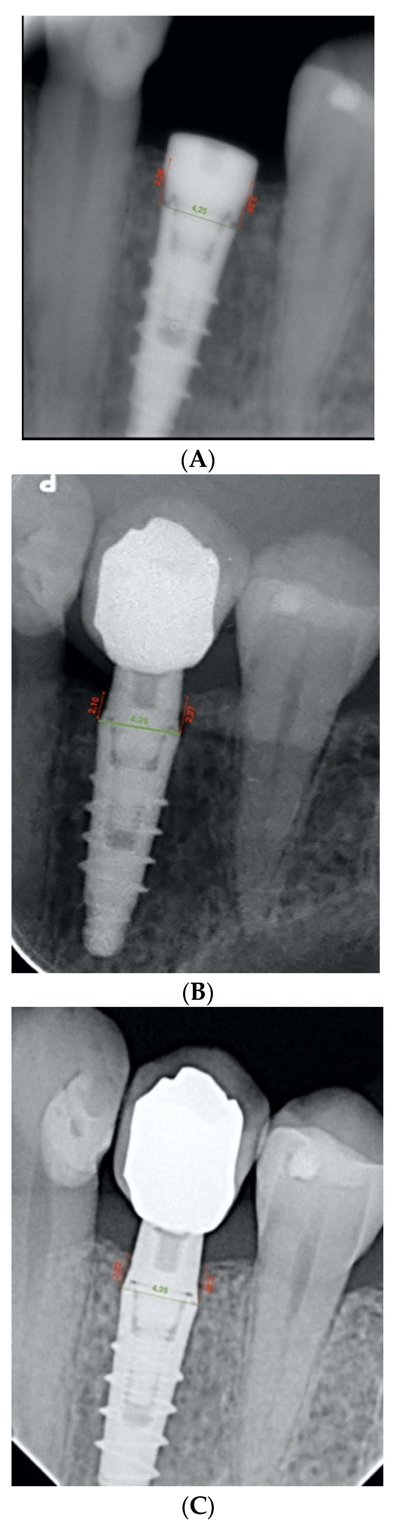 Ijerph 19 03443 g006 550