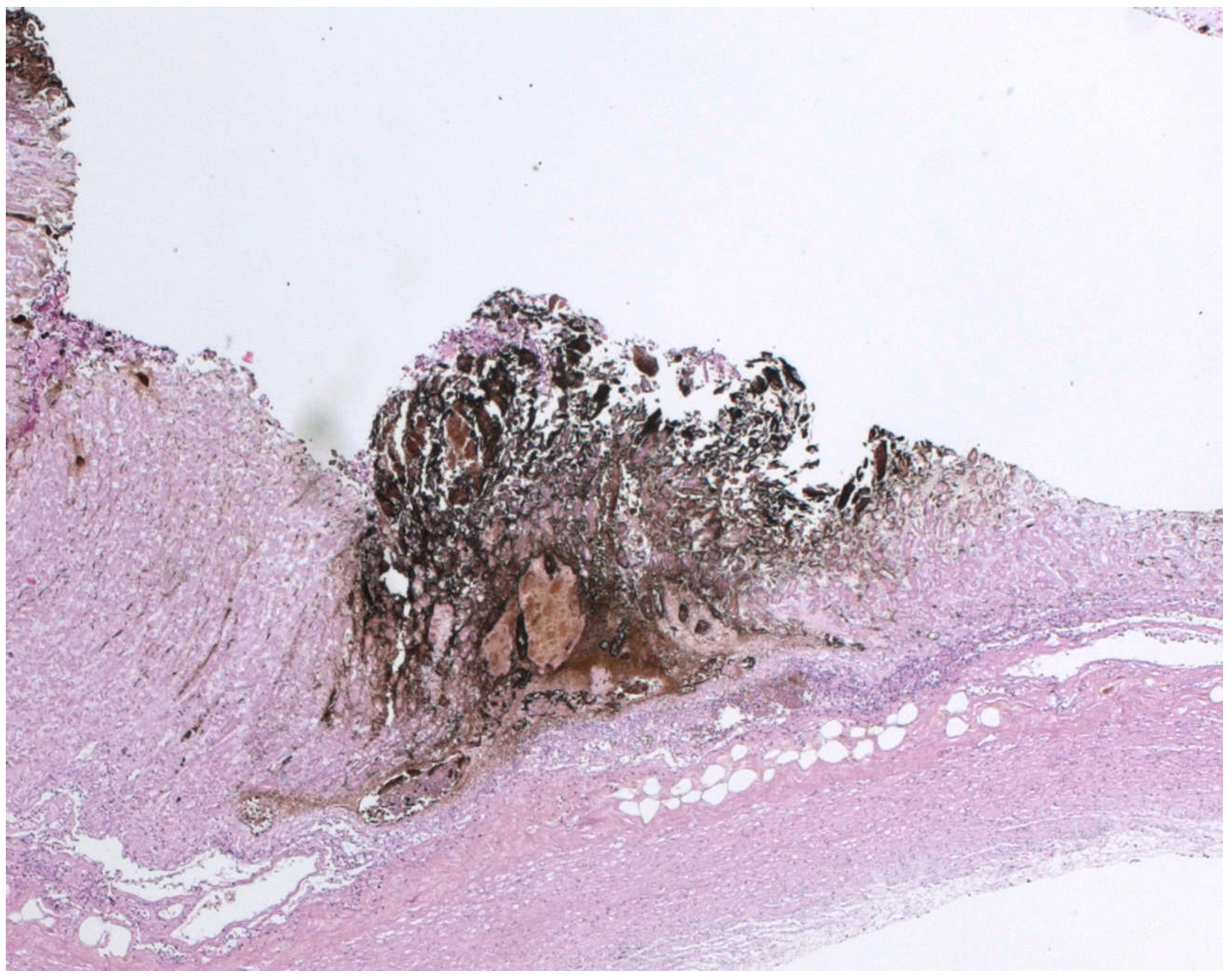 Ijerph 19 03601 g002