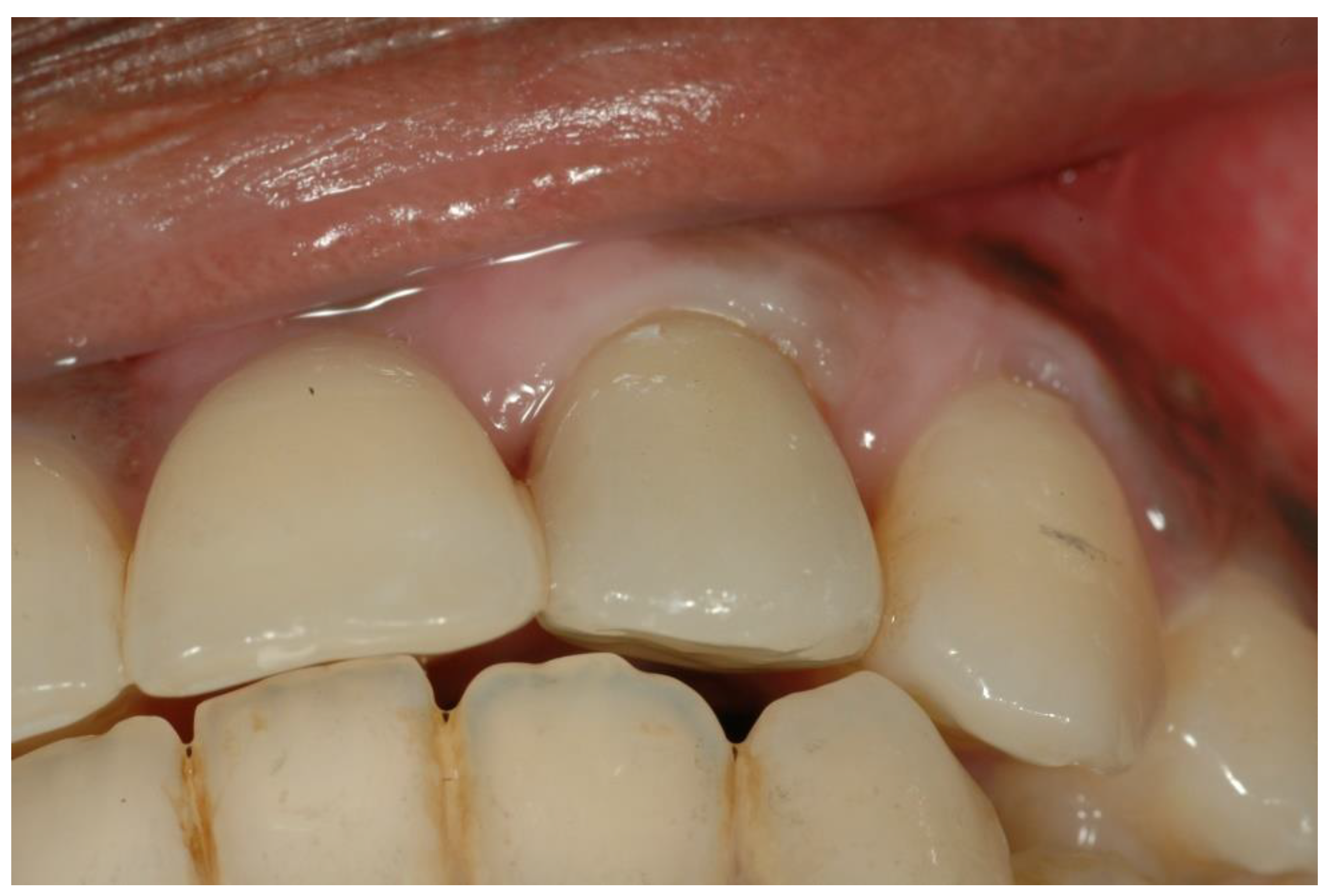 Ijerph 19 03689 g004 550