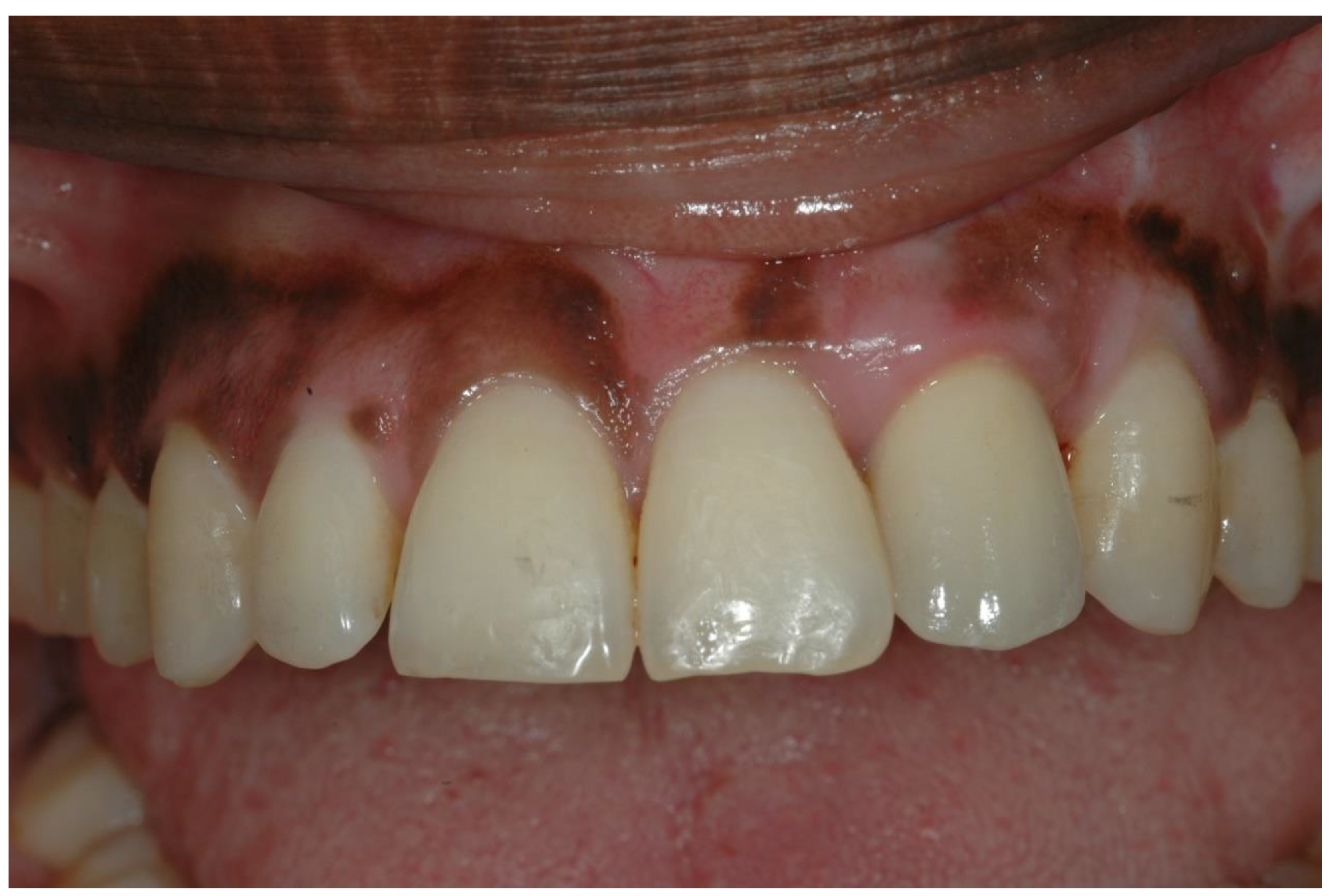 Ijerph 19 03689 g008 550