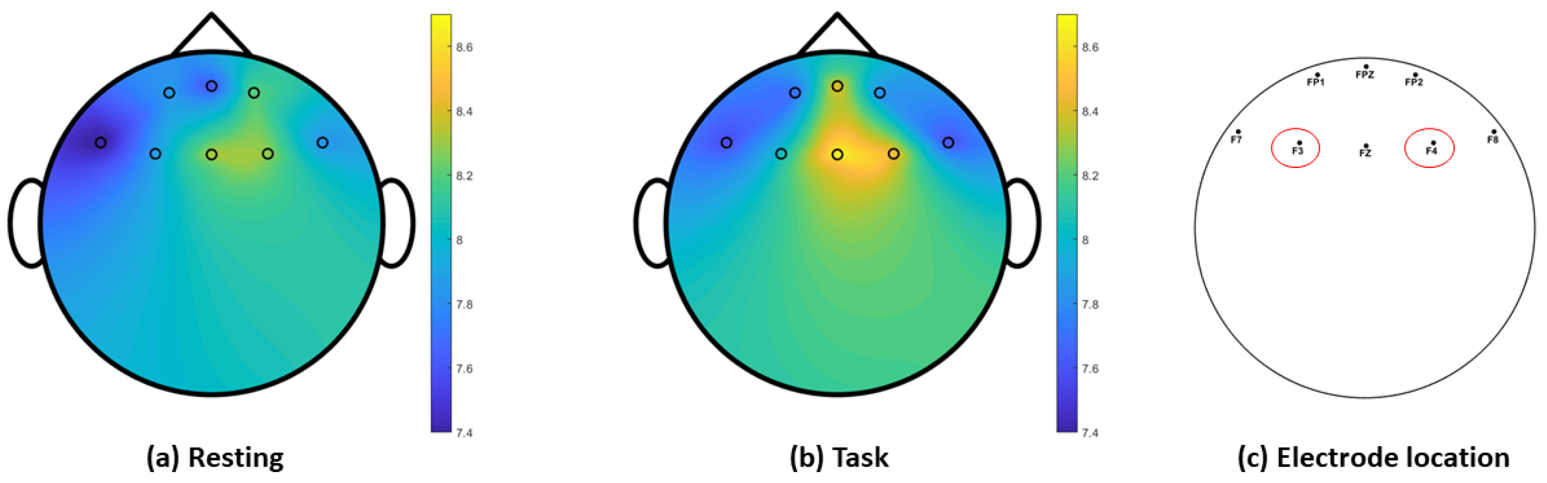 Ijerph Free Full Text Resilience Building For Mental Health Among Early Childhood Educators A Systematic Review And Pilot Study Towards An Eeg Vr Resilience Building Intervention Html