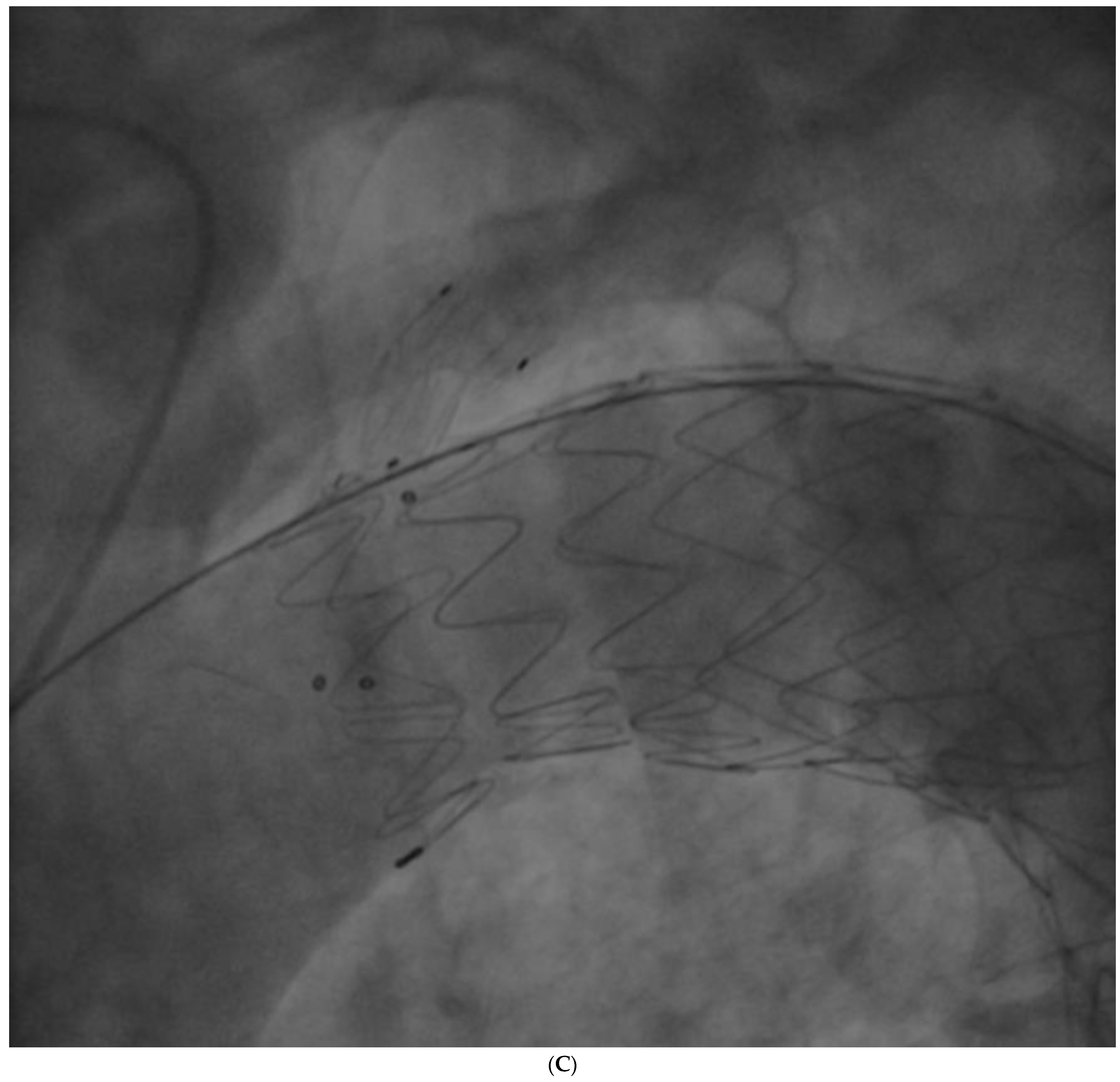 Ijerph 19 04809 g005c 550