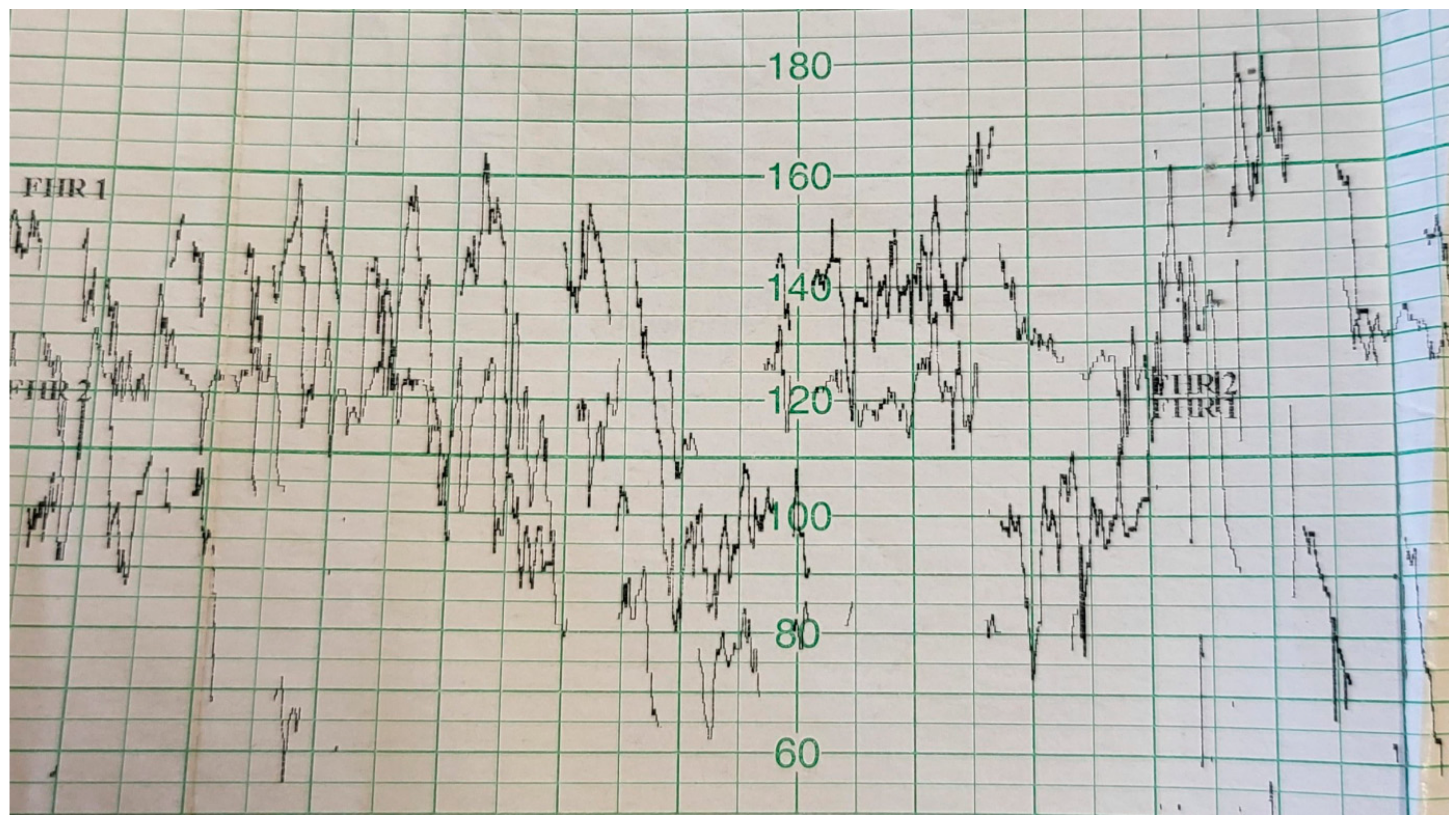Ijerph 19 05027 g005