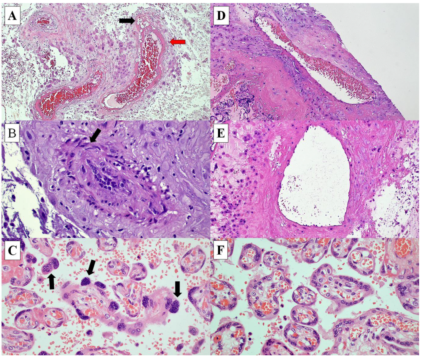 Ijerph 19 05448 g002