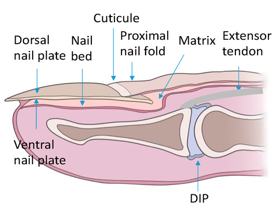 Nail (fastener) - Wikipedia