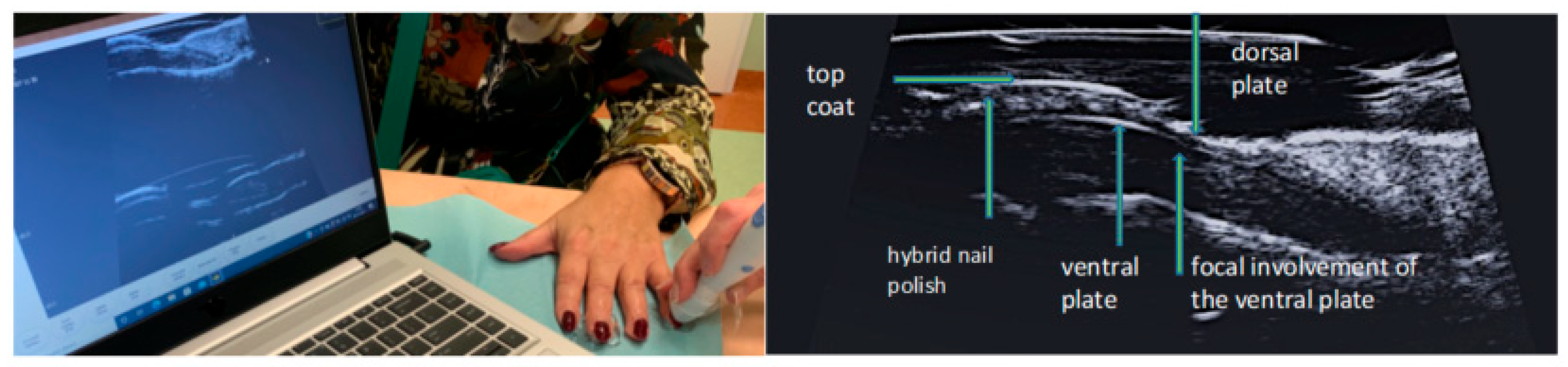 Ijerph 19 05611 g007 550