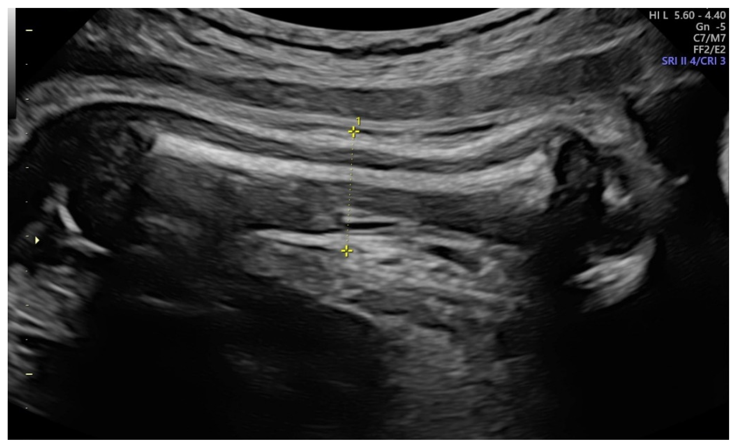 Ijerph 19 05747 g001 550