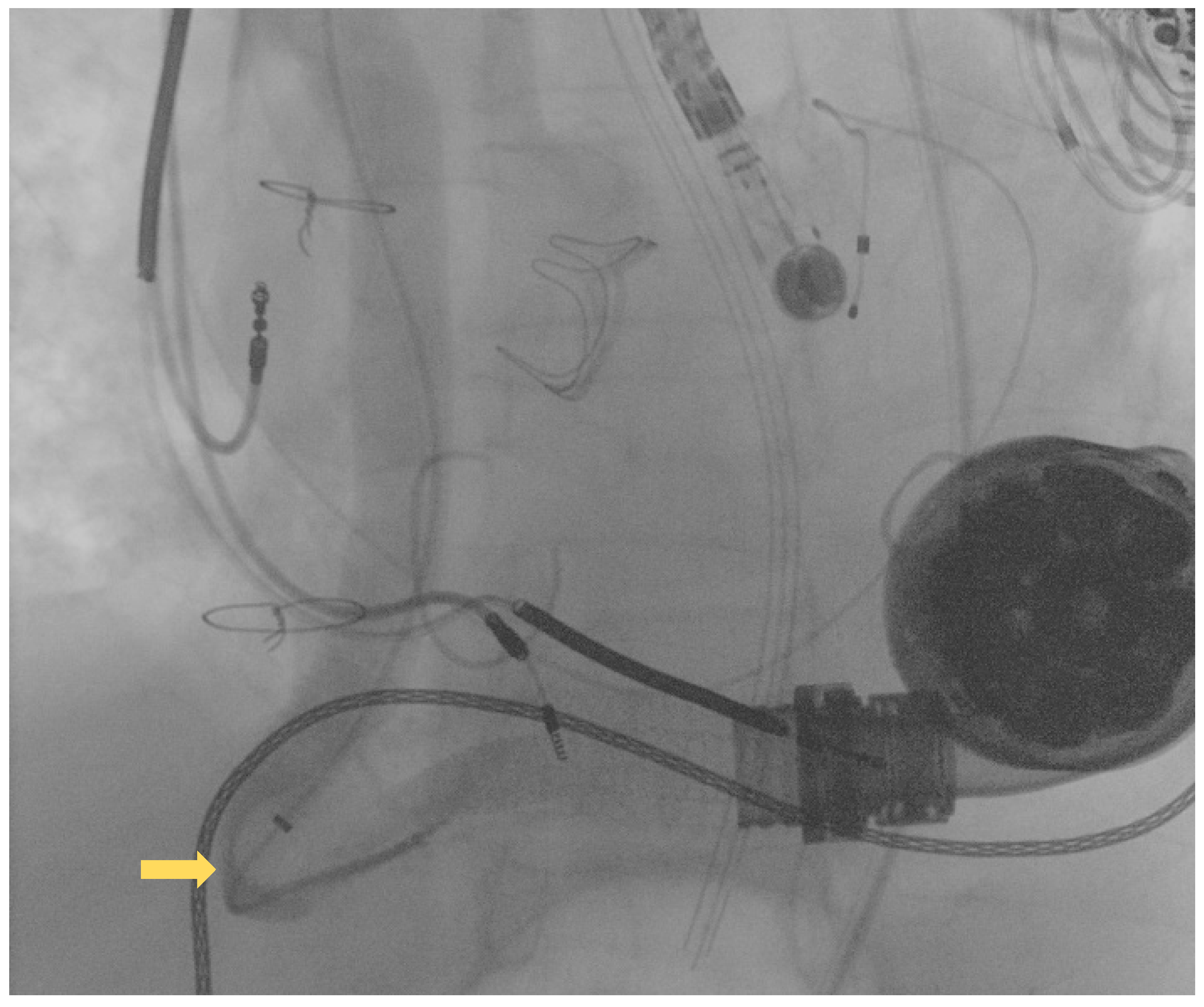 Ijerph 19 05976 g002 550