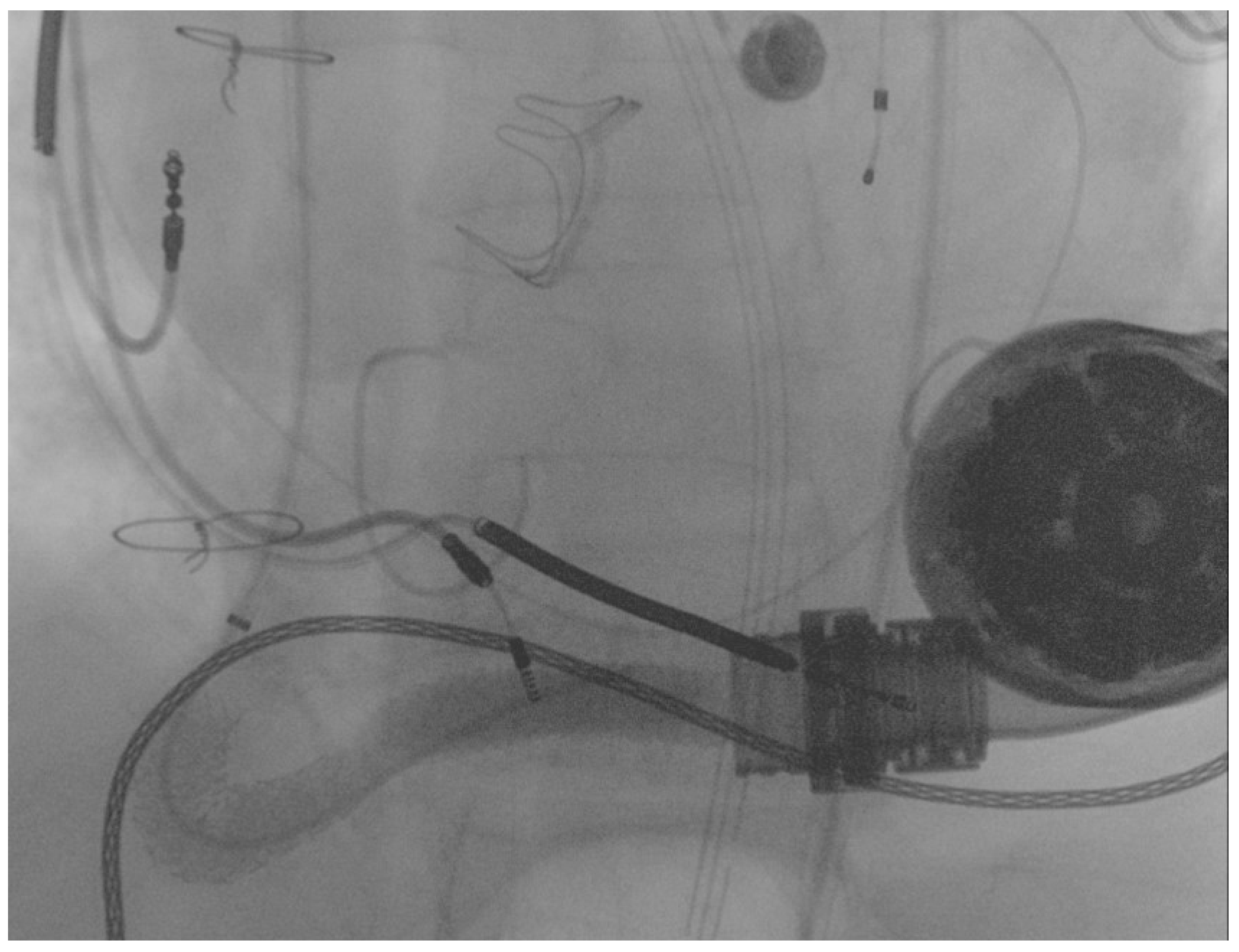 Ijerph 19 05976 g005 550