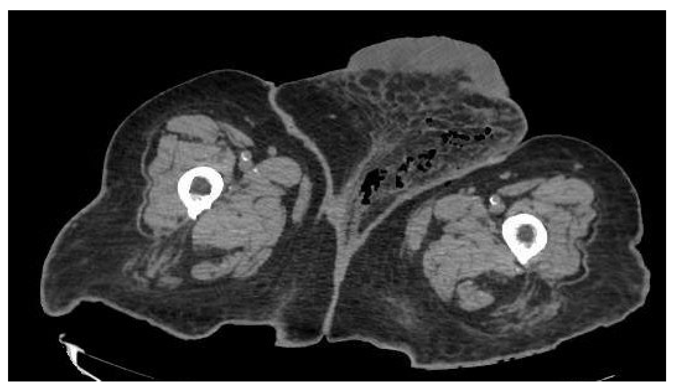 Ijerph 19 06261 g004