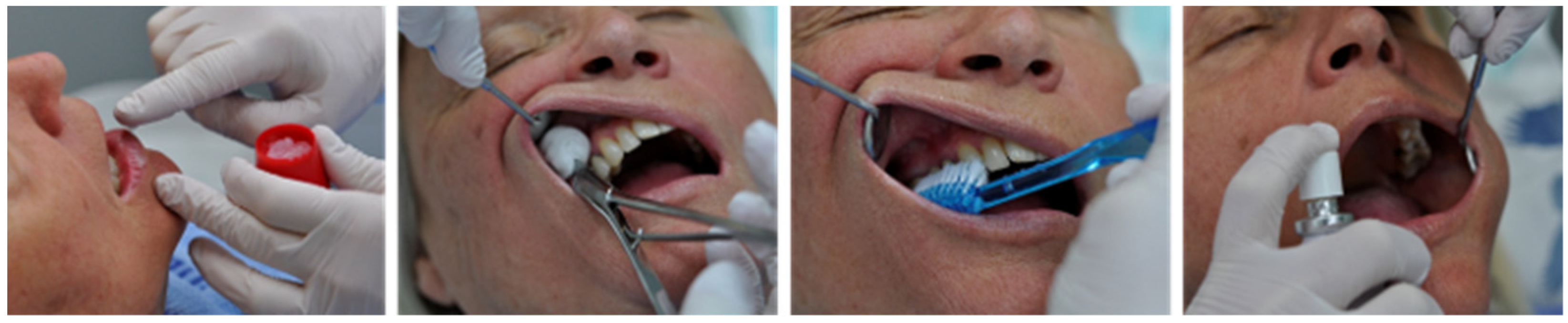 IJERPH Free FullText A Narrative of Oral Care in Palliative Patients