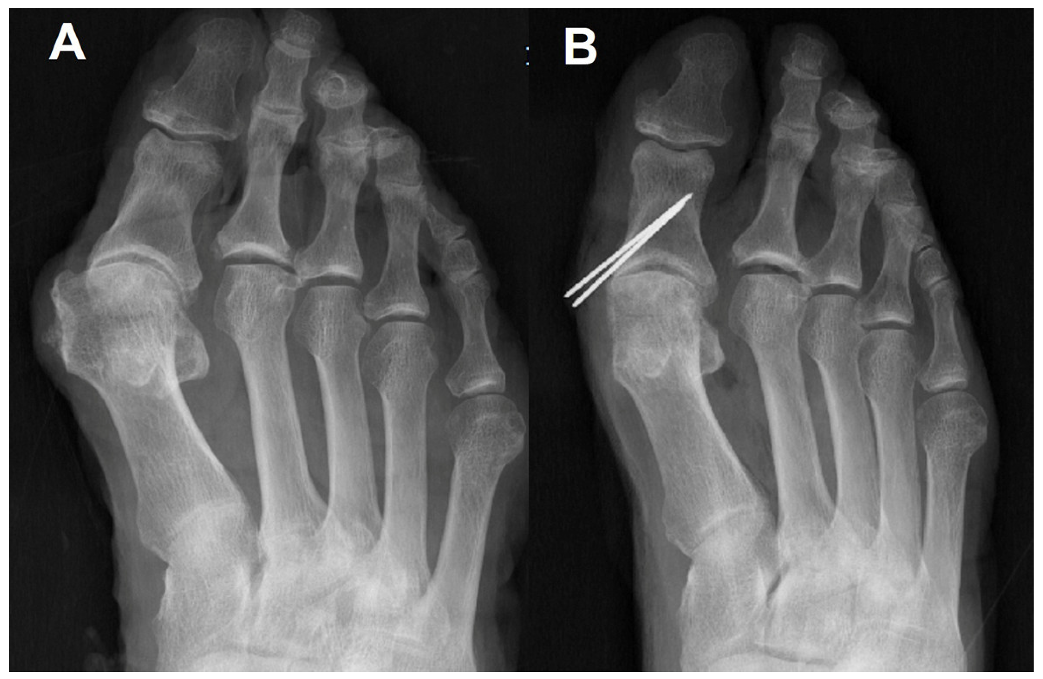 Ijerph 19 06487 g003 550