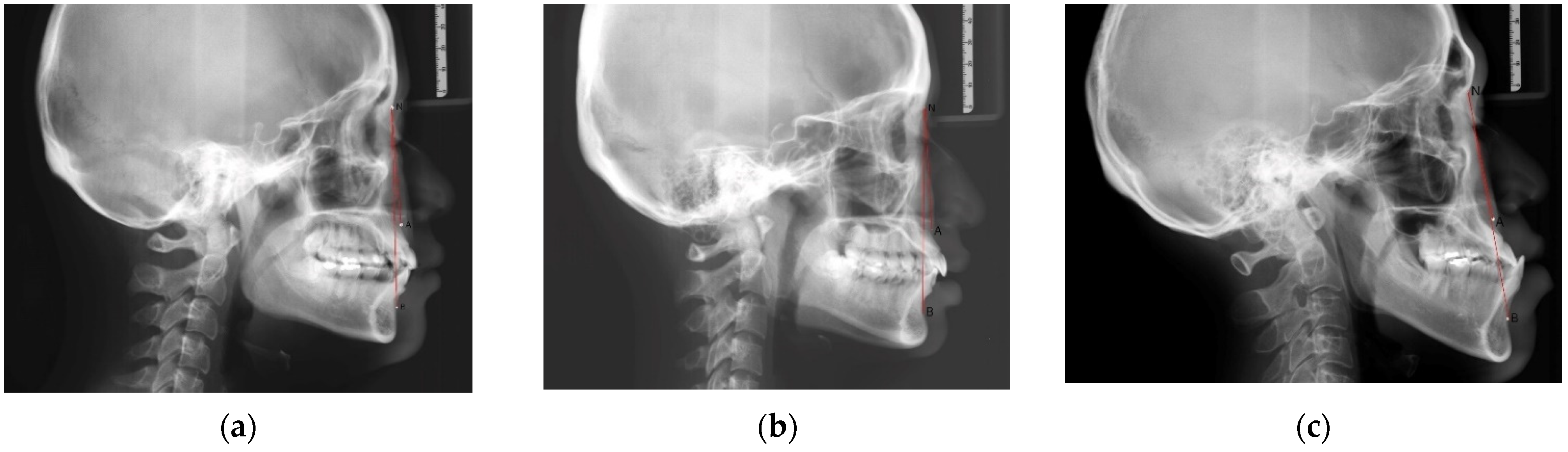 Ijerph 19 06569 g002 550