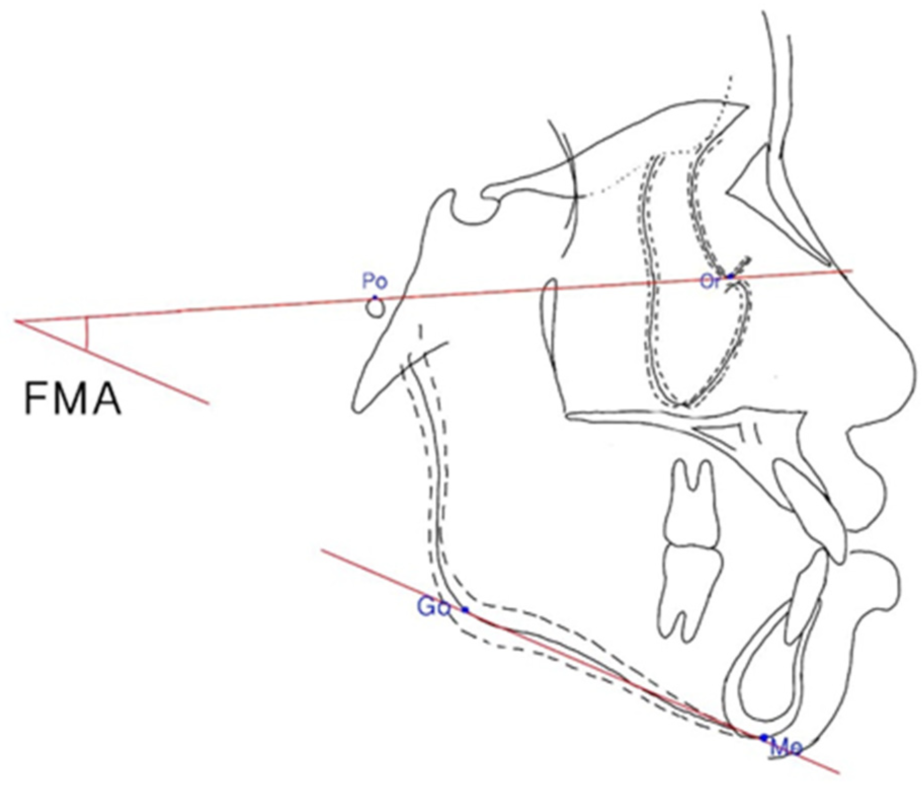 Ijerph 19 06569 g004 550