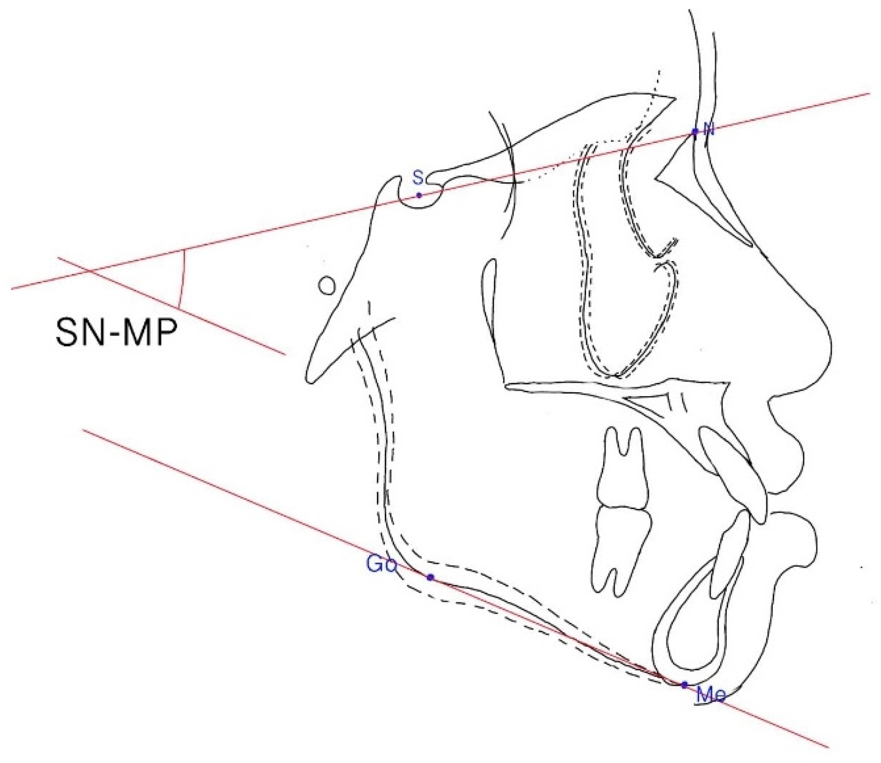 Ijerph 19 06569 g005 550