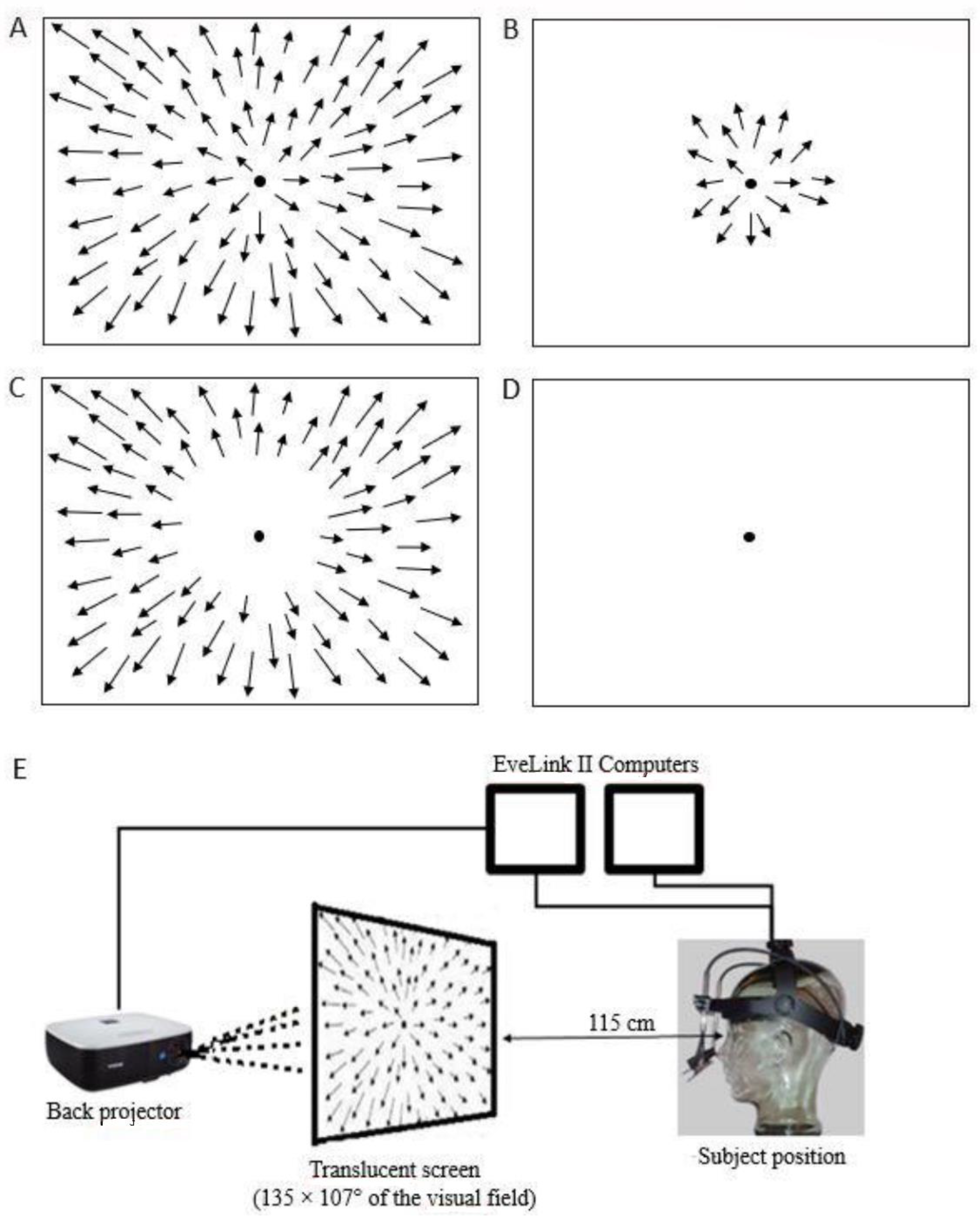 Visual Discrimination - Vegetable (Lv. 2A)