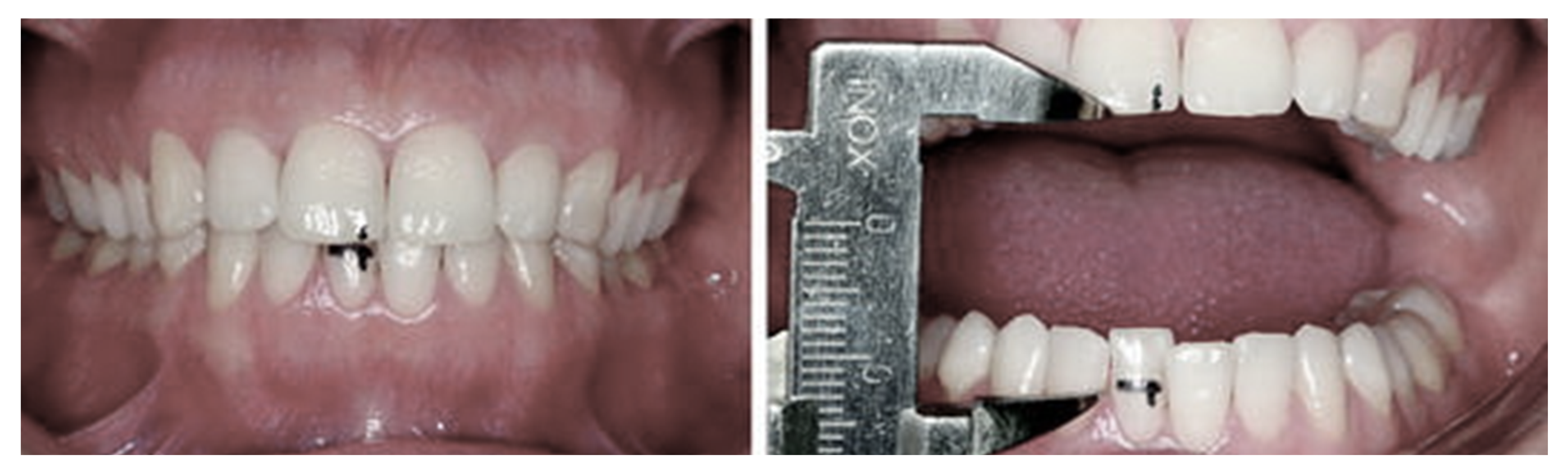 Ijerph 19 06888 g004 550