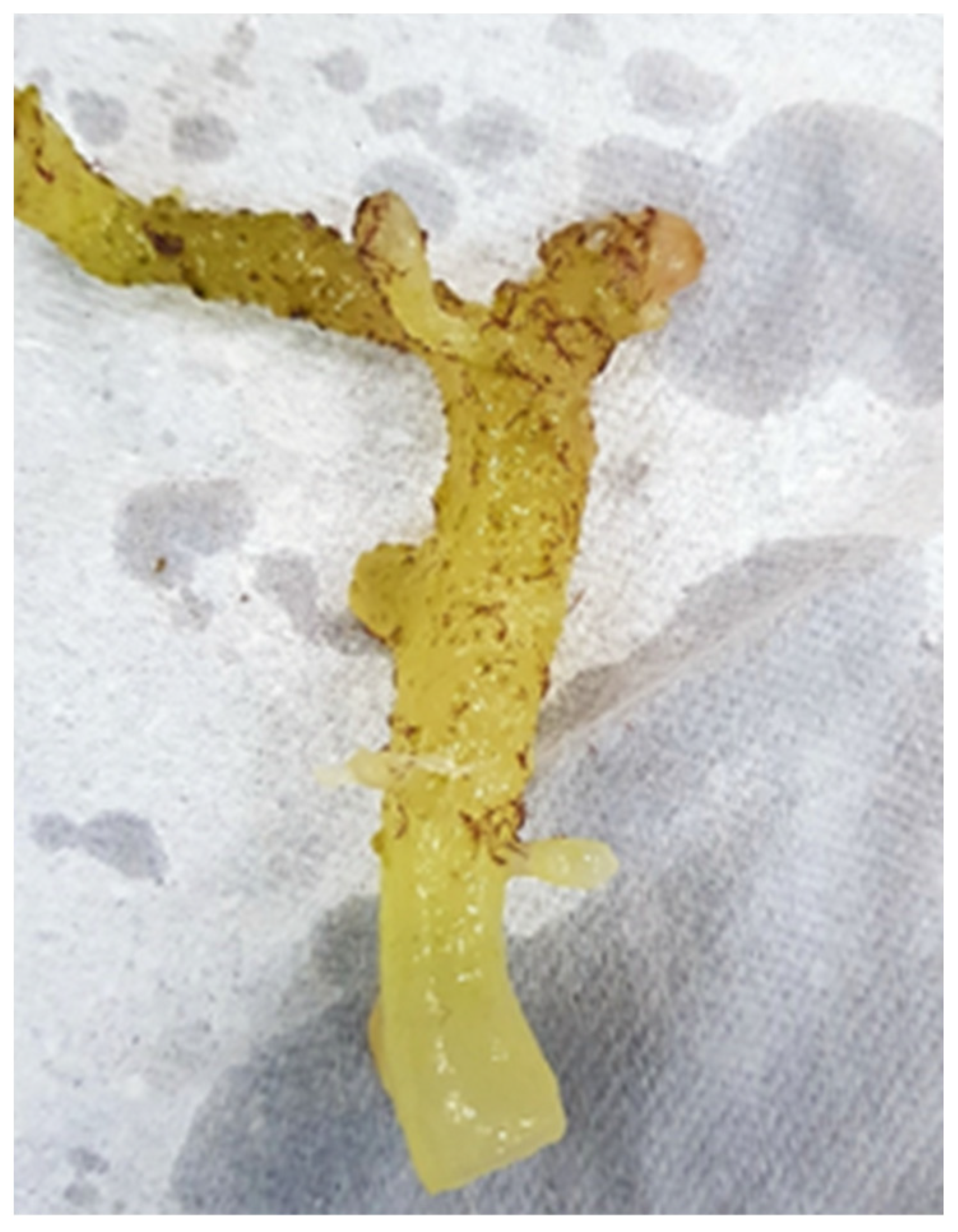 Ijerph 19 07087 g004 550