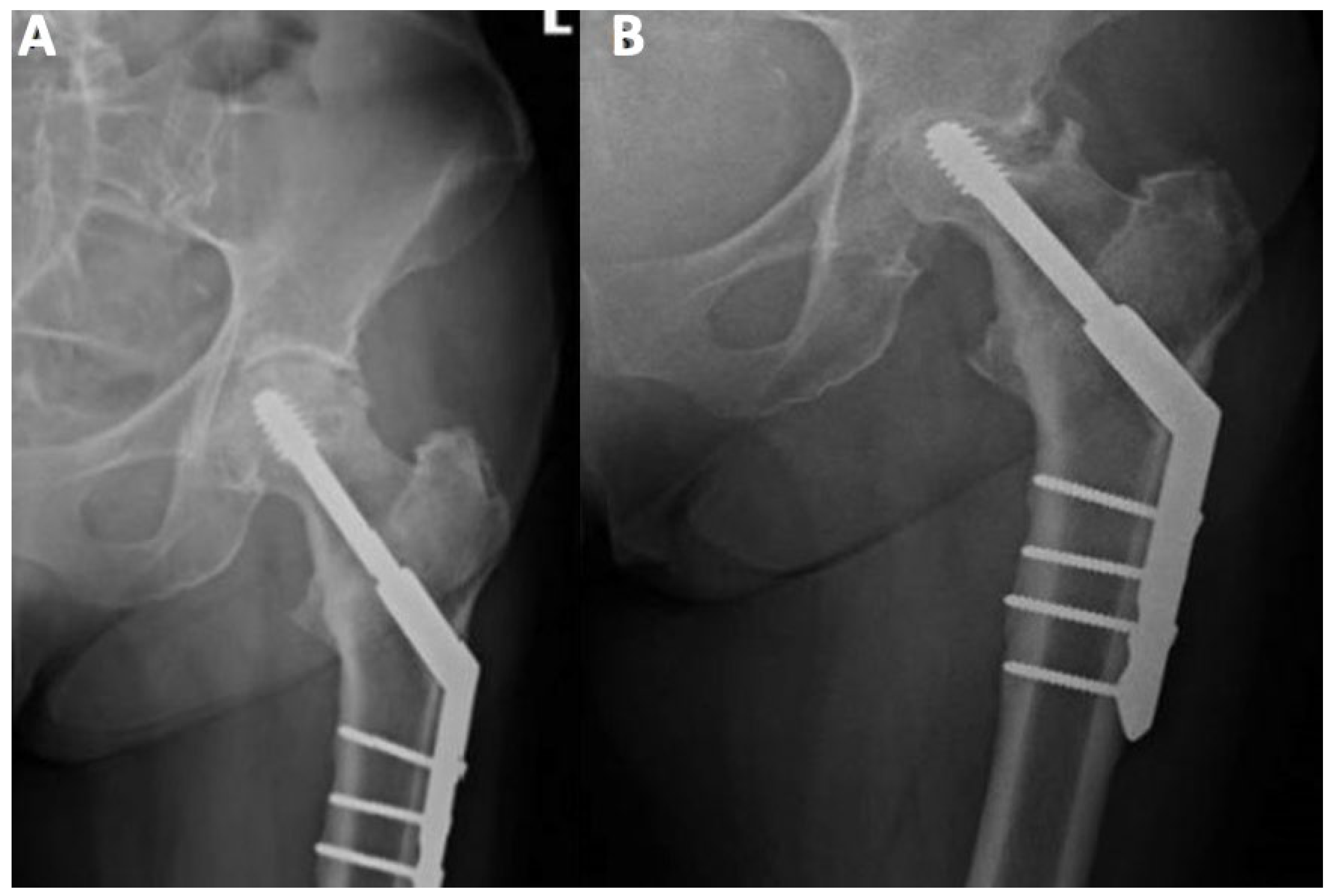 Ijerph 19 07348 g002 550