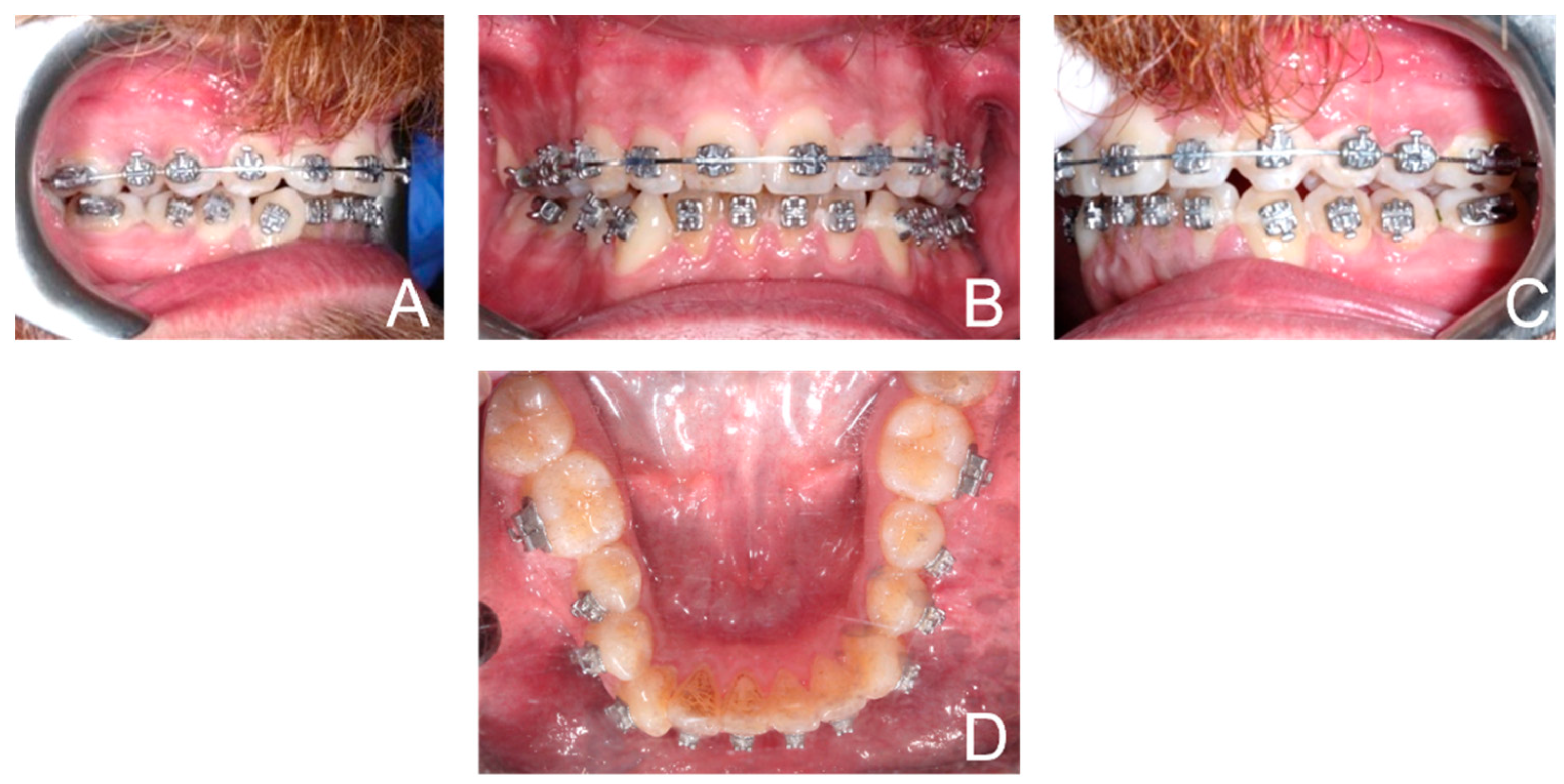 Ijerph 19 07448 g004 550
