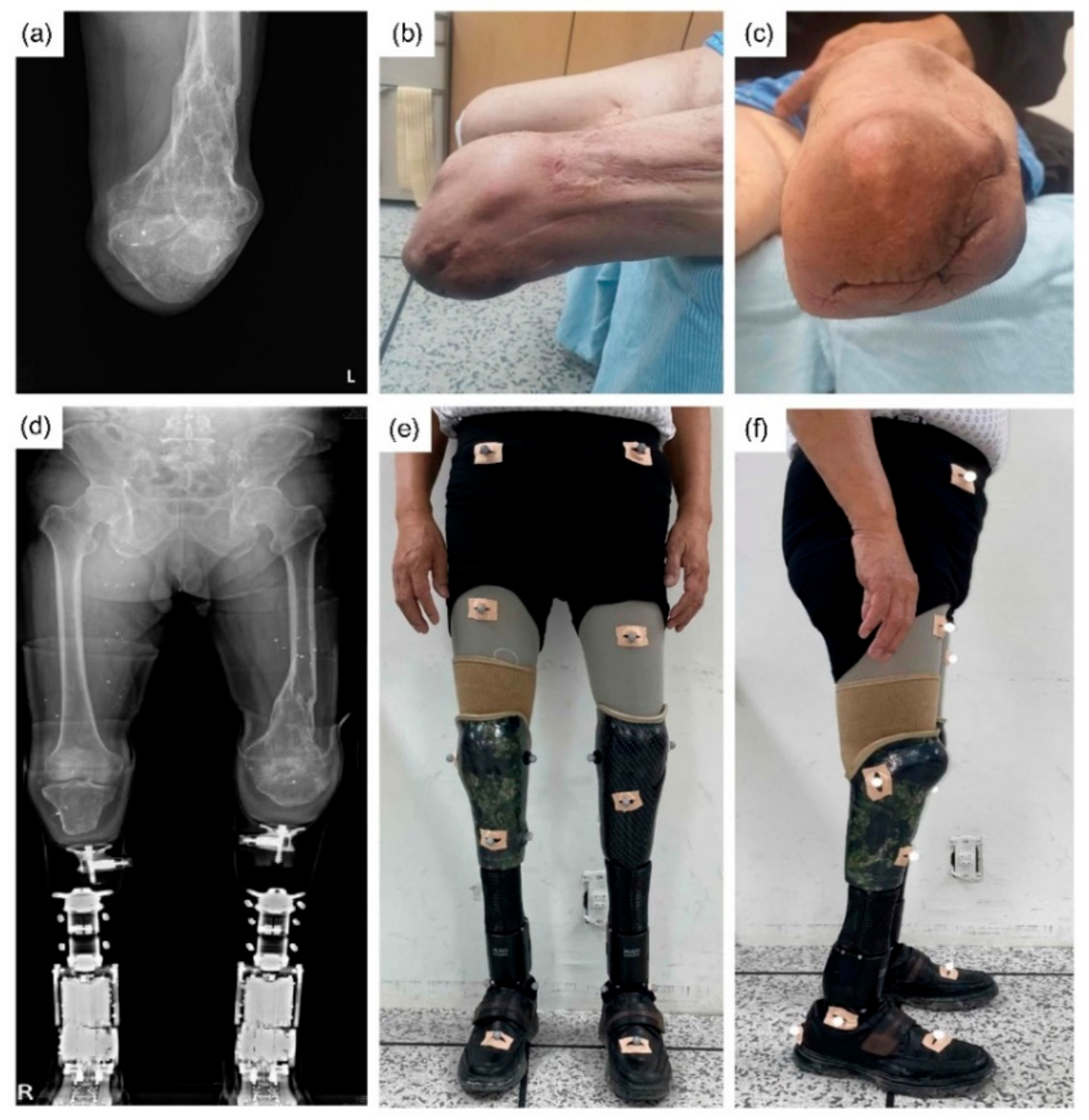 Orthotics and prosthetics - ORTHOTICS and PROSTHETICS