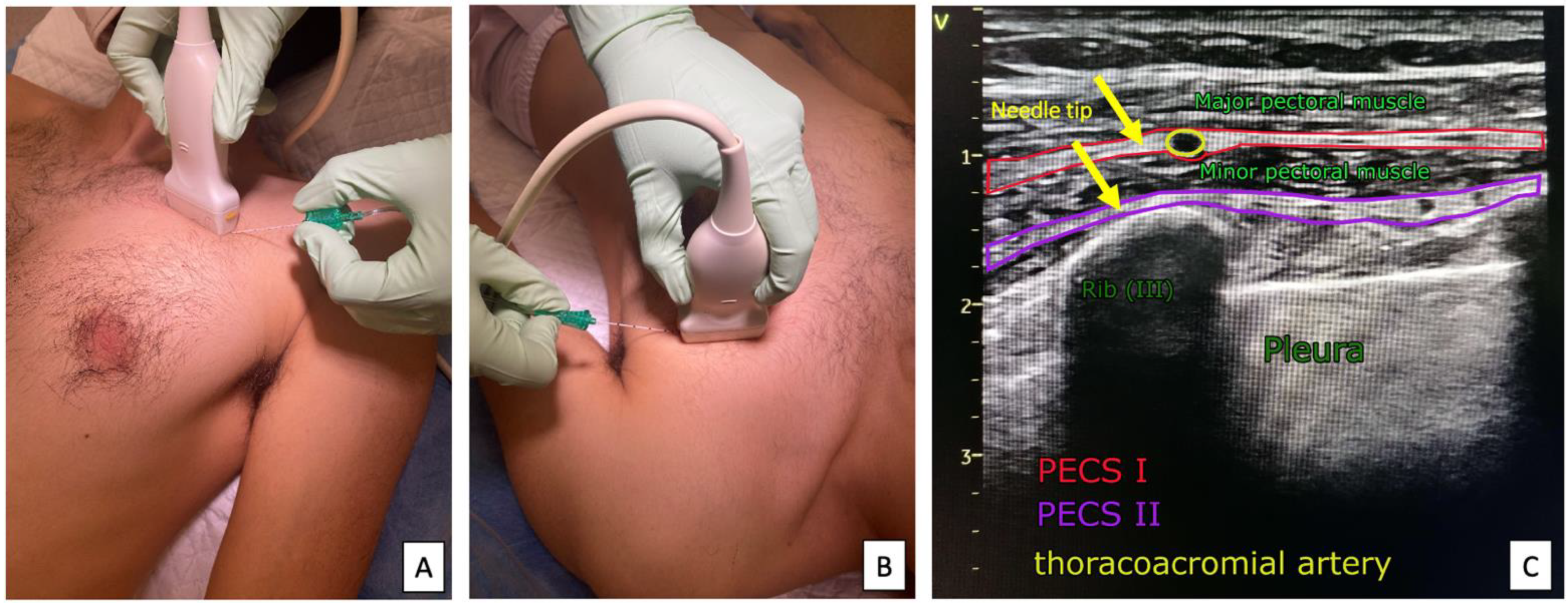 Ijerph 19 08696 g004