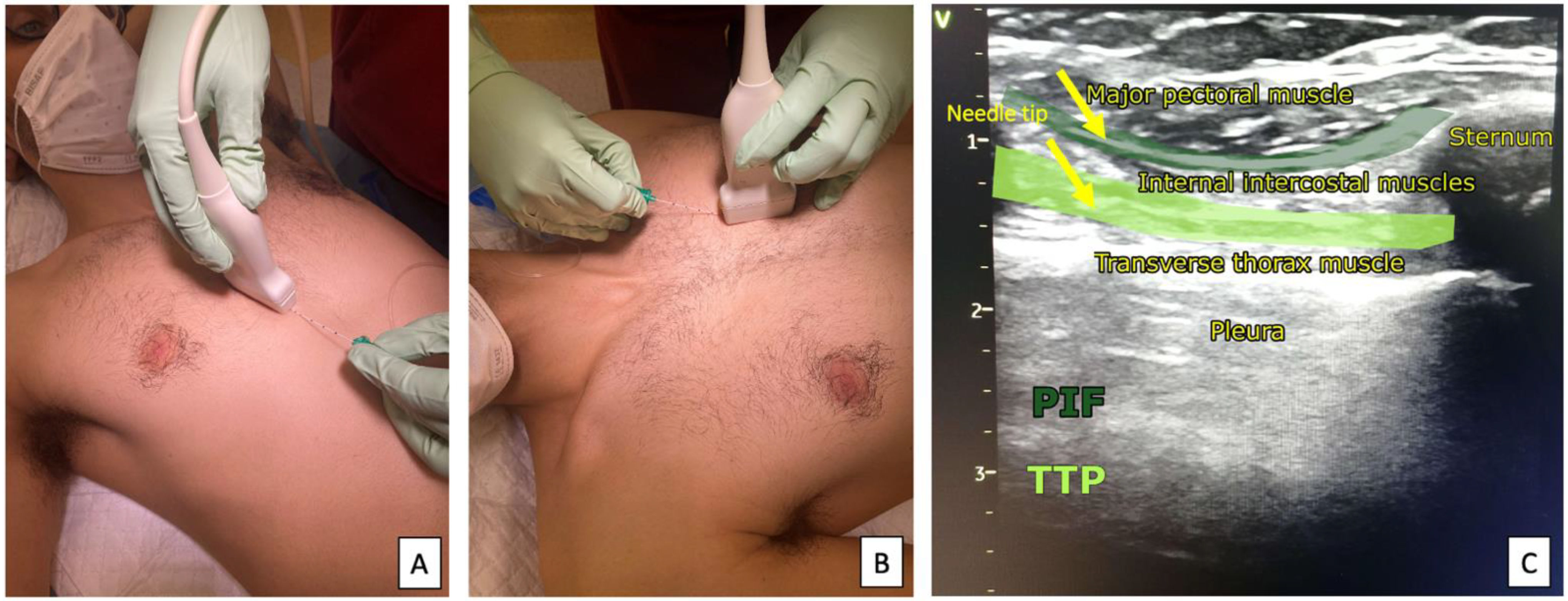 Ijerph 19 08696 g006