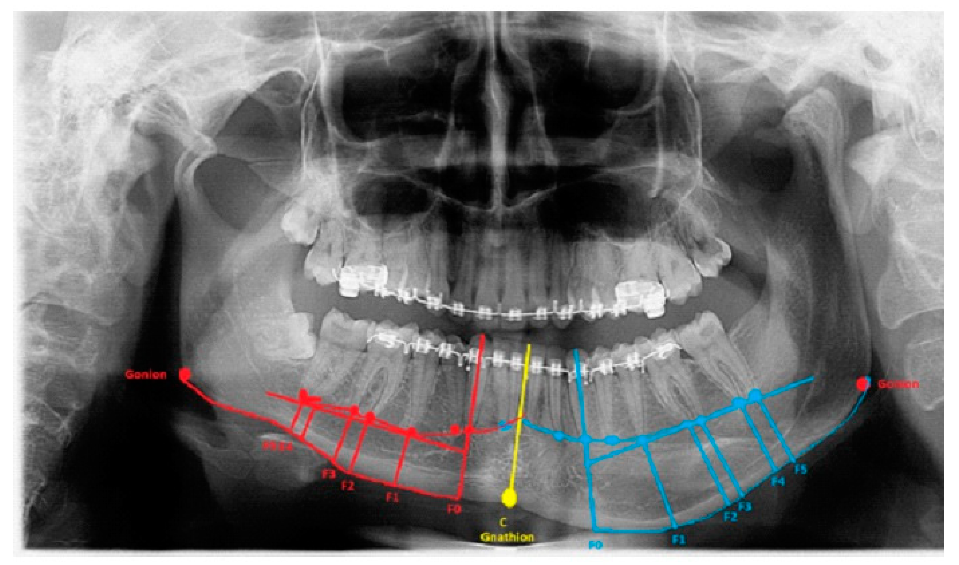 Ijerph 19 10005 g002 550
