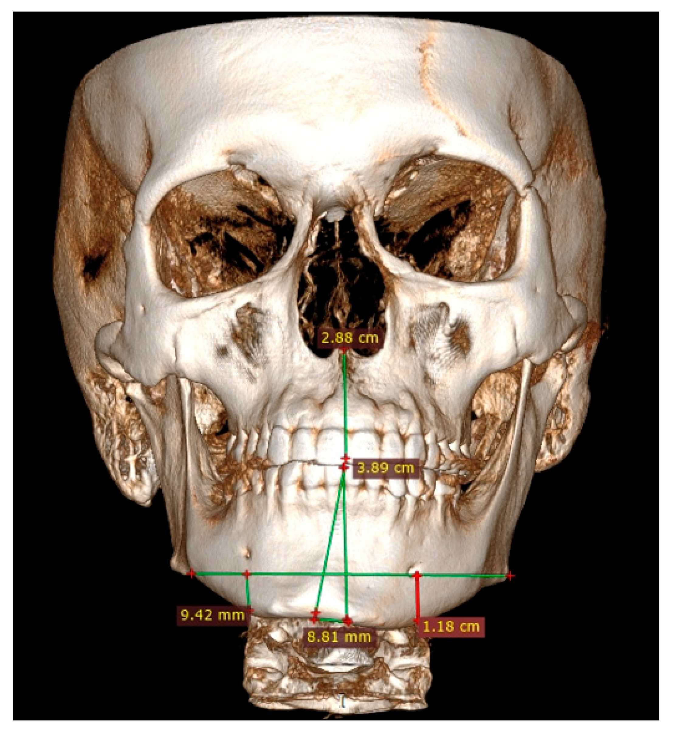 Ijerph 19 10005 g003 550