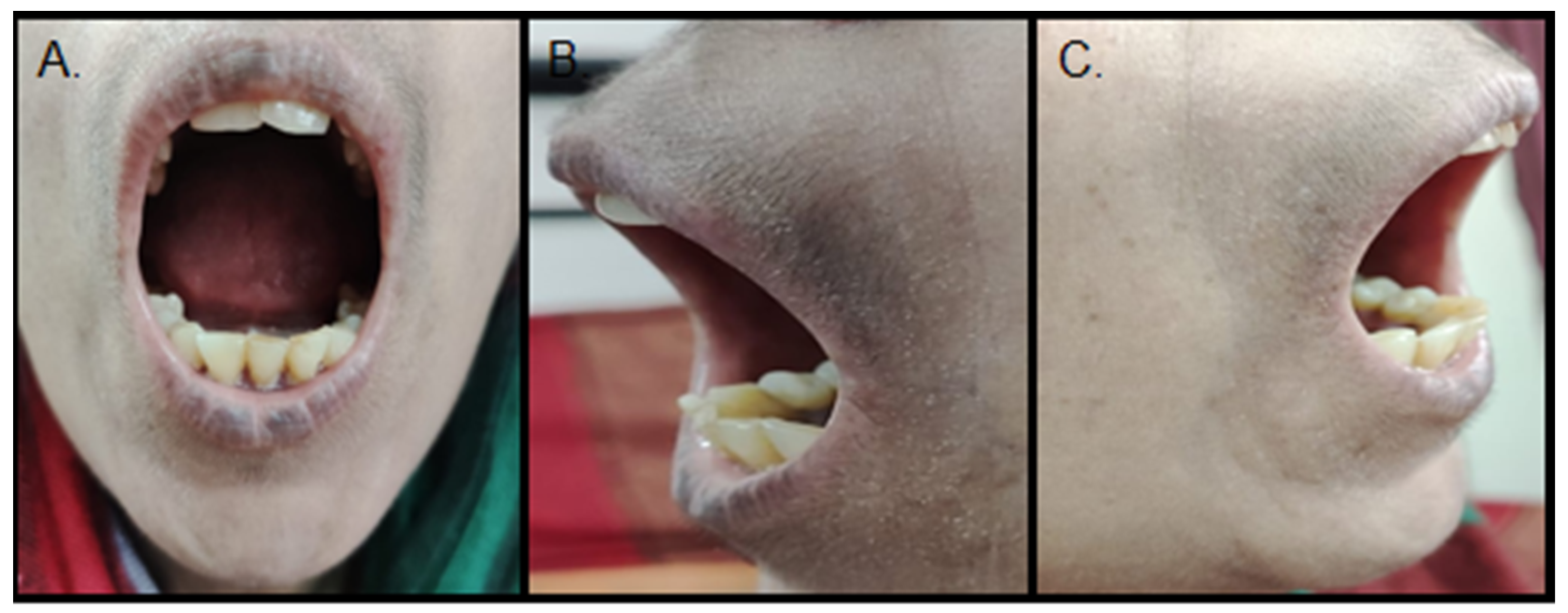 Ijerph 19 10066 g004 550