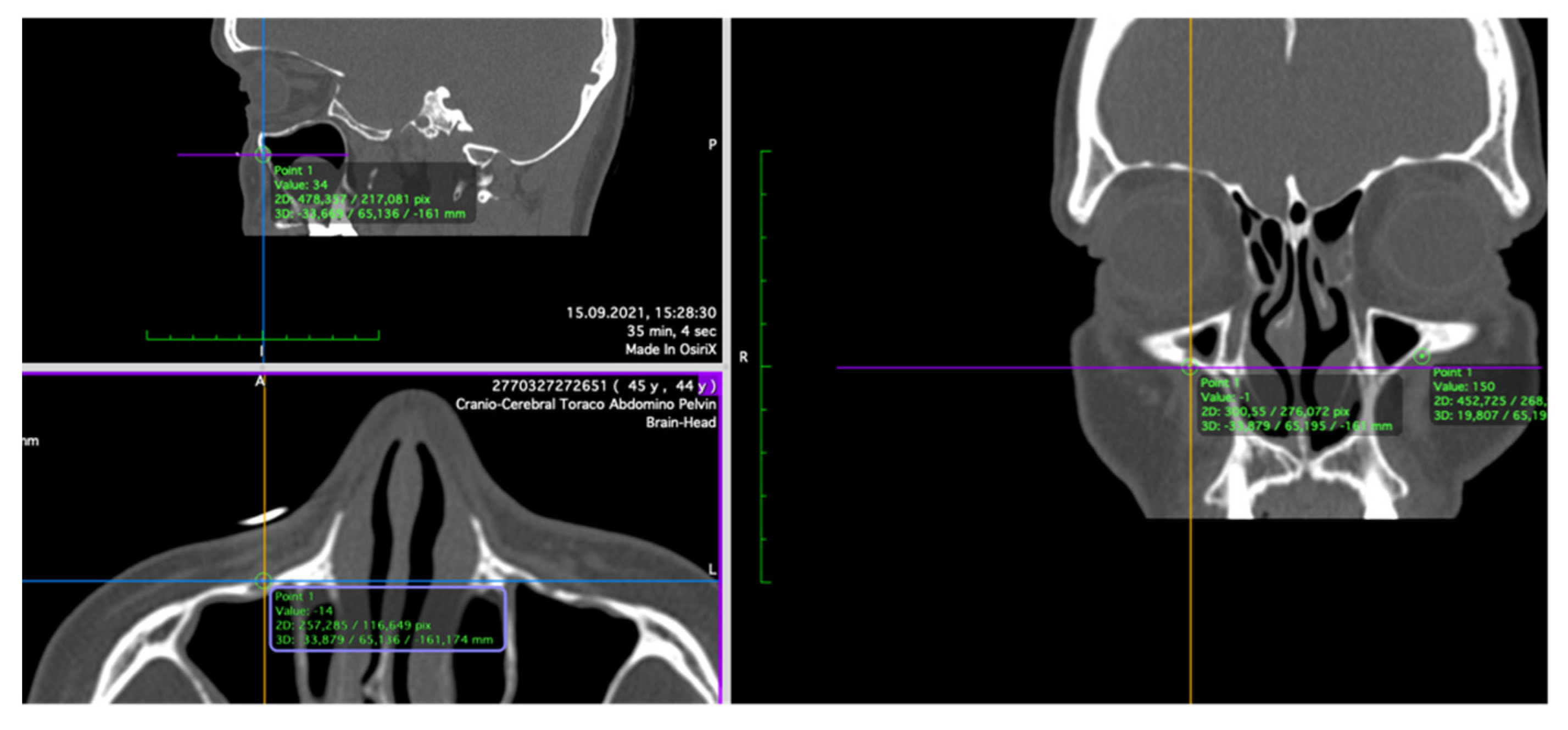 Ijerph 19 10412 g002