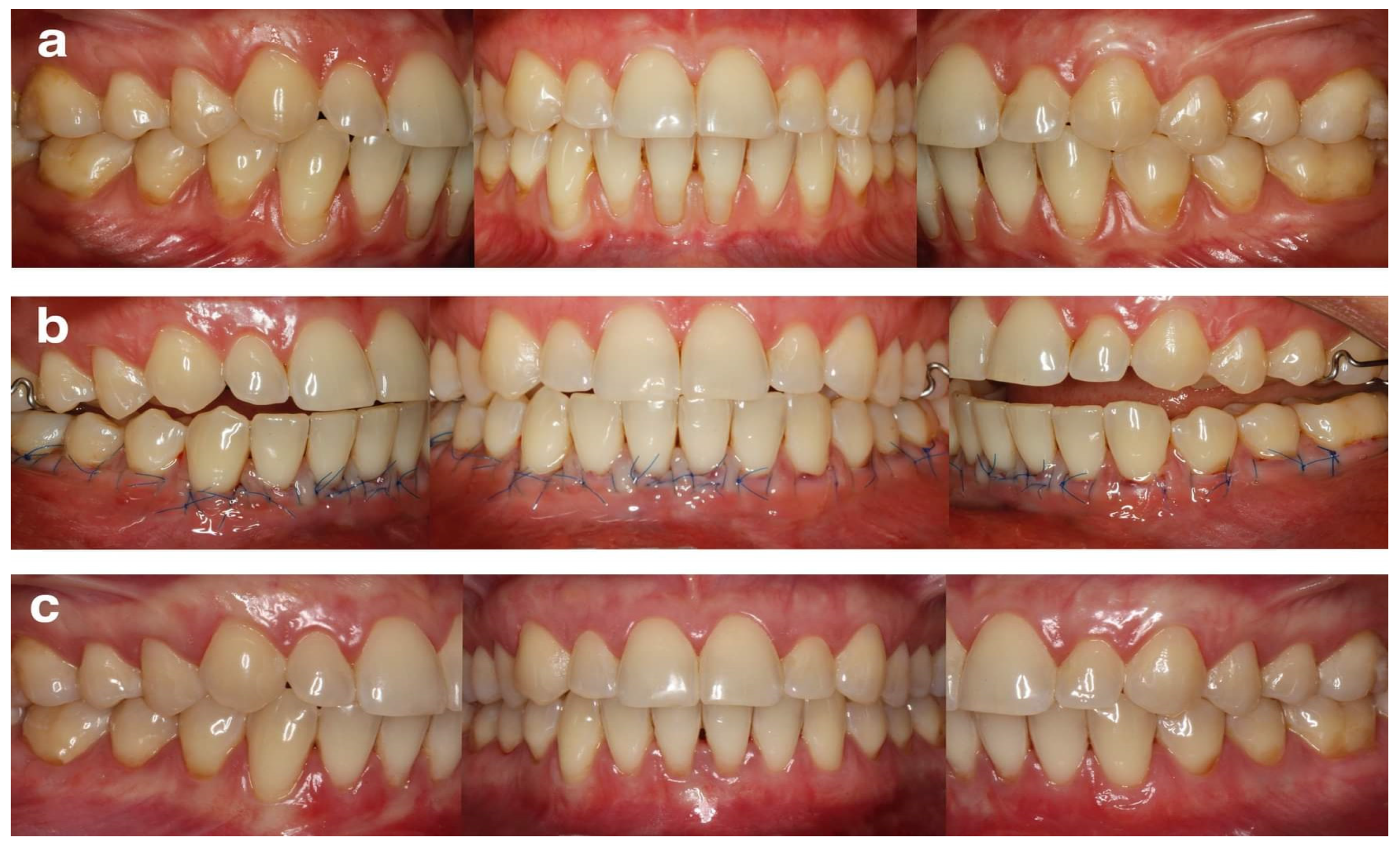 Ijerph 19 11024 g002 550