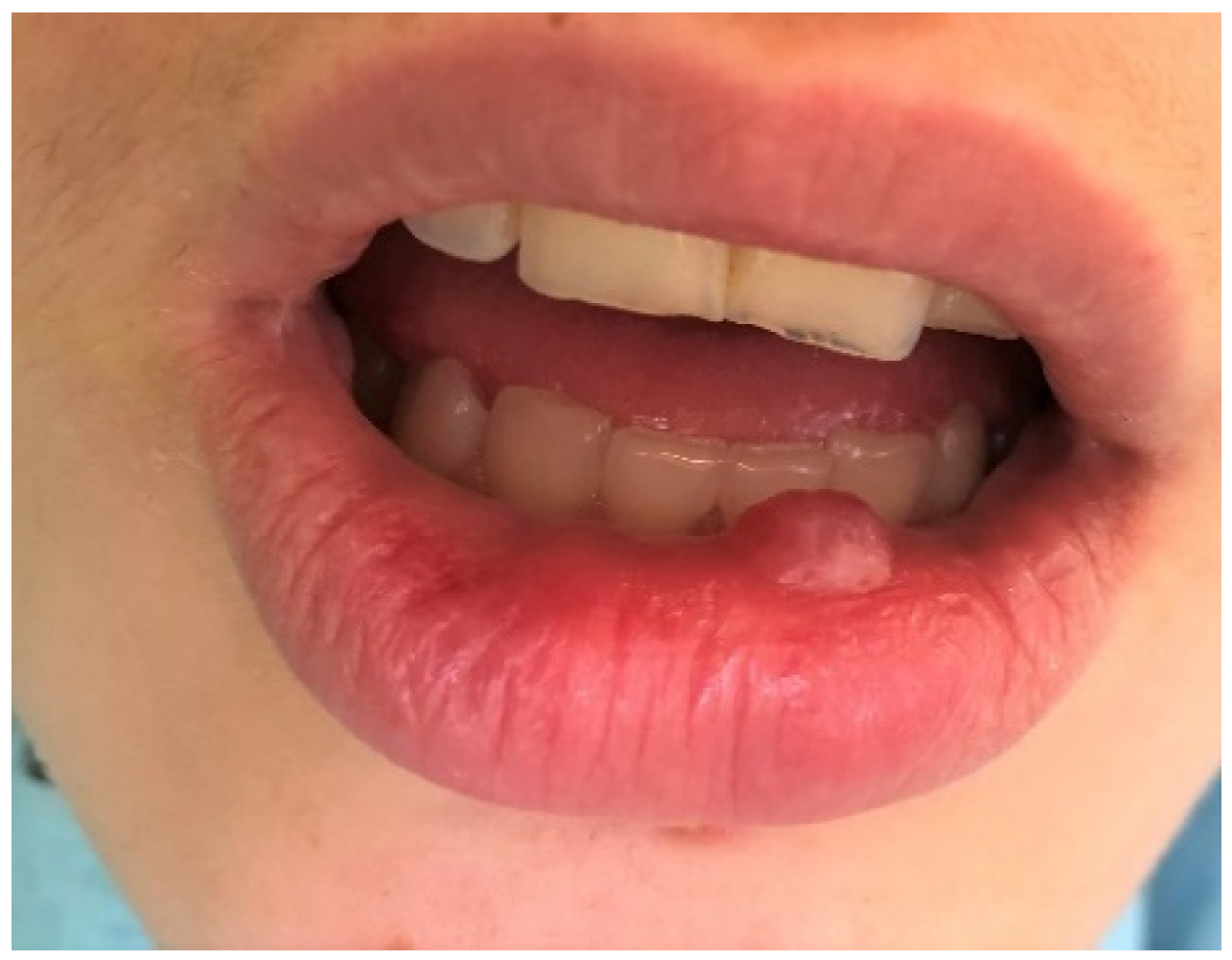 Ijerph 19 11277 g004 Ijerph 19 11277 g004