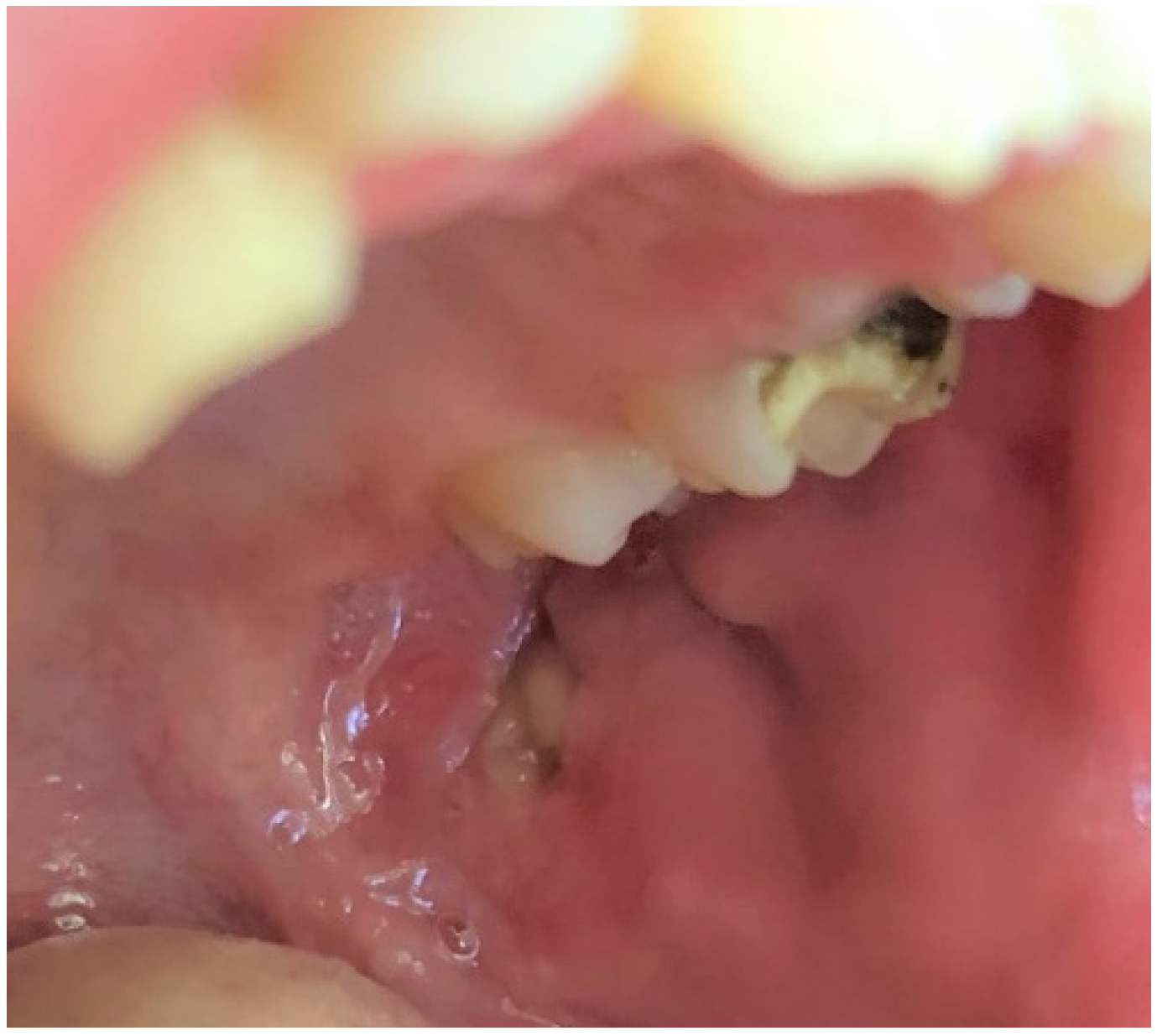 Ijerph 19 11277 g011 Ijerph 19 11277 g011