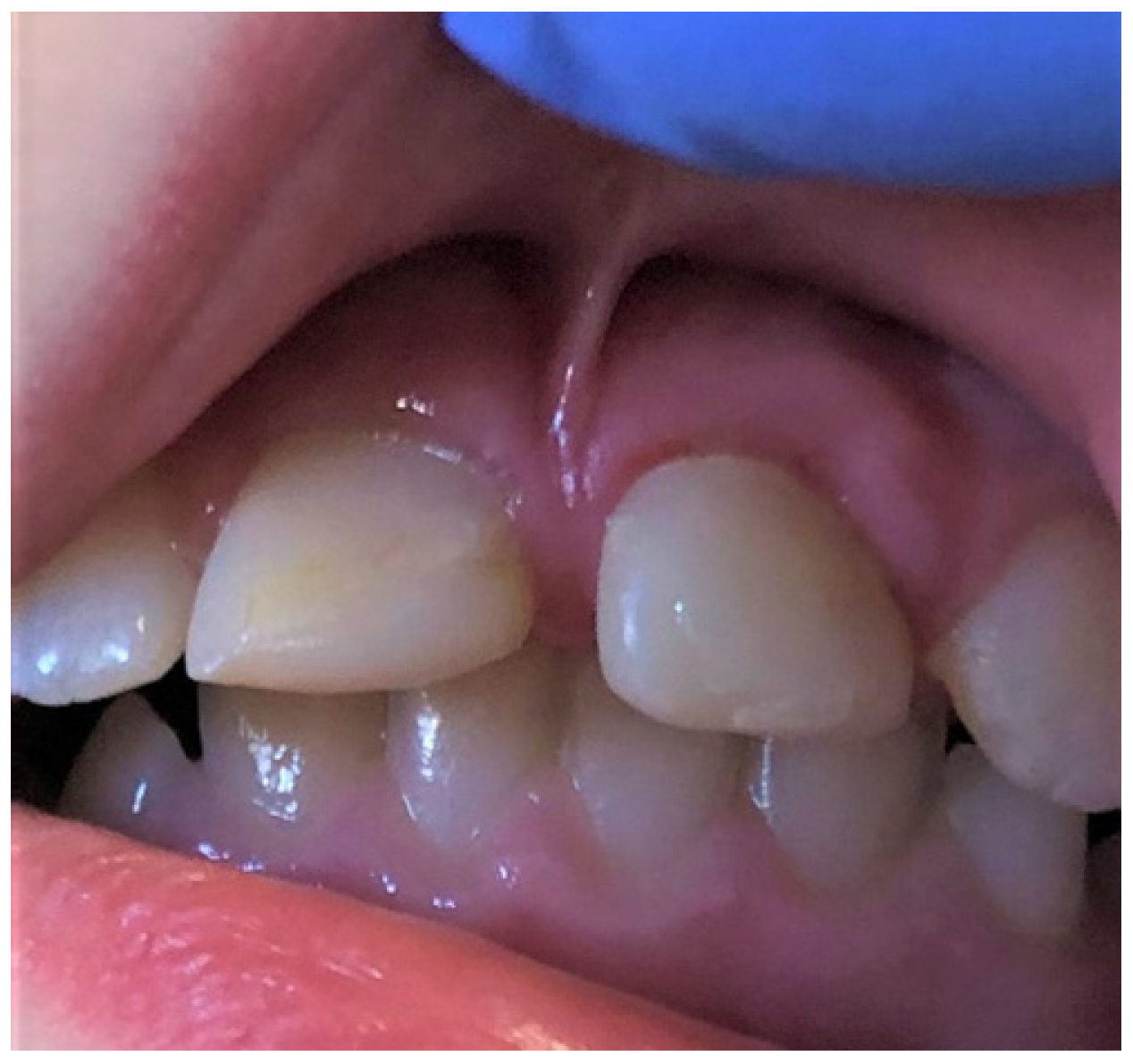 Ijerph 19 11277 g012 Ijerph 19 11277 g012